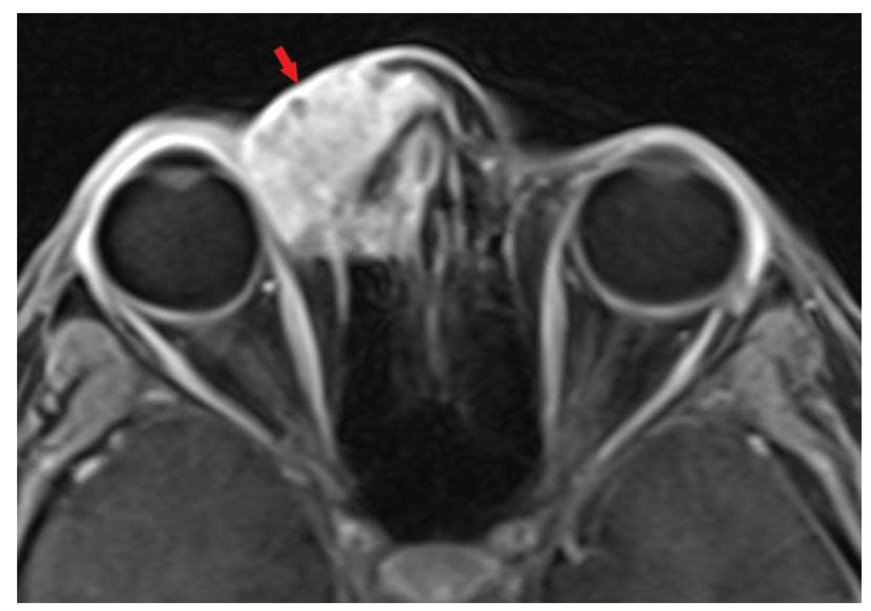 Biomedicines 11 01538 g003 550