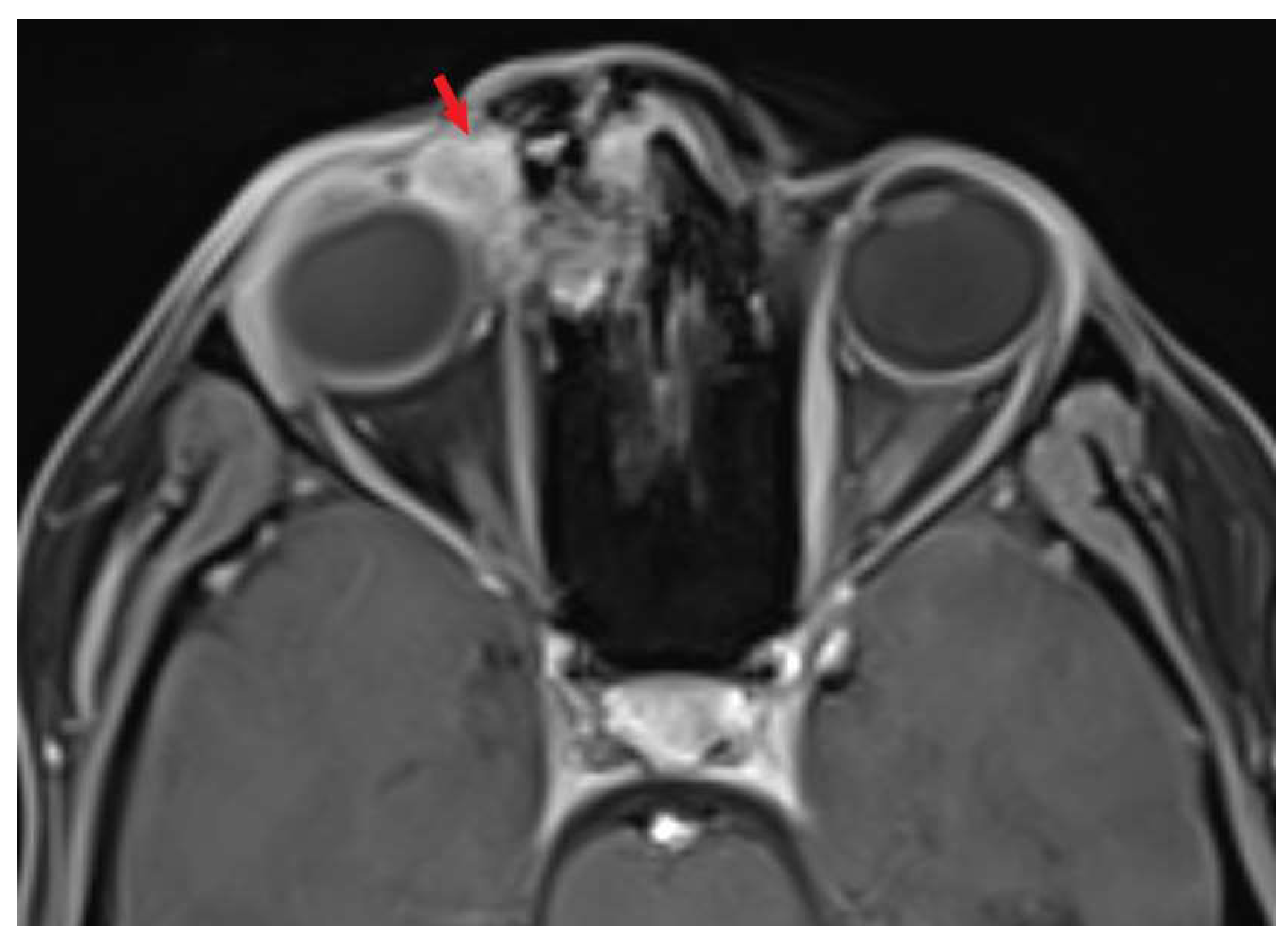Biomedicines 11 01538 g004 550