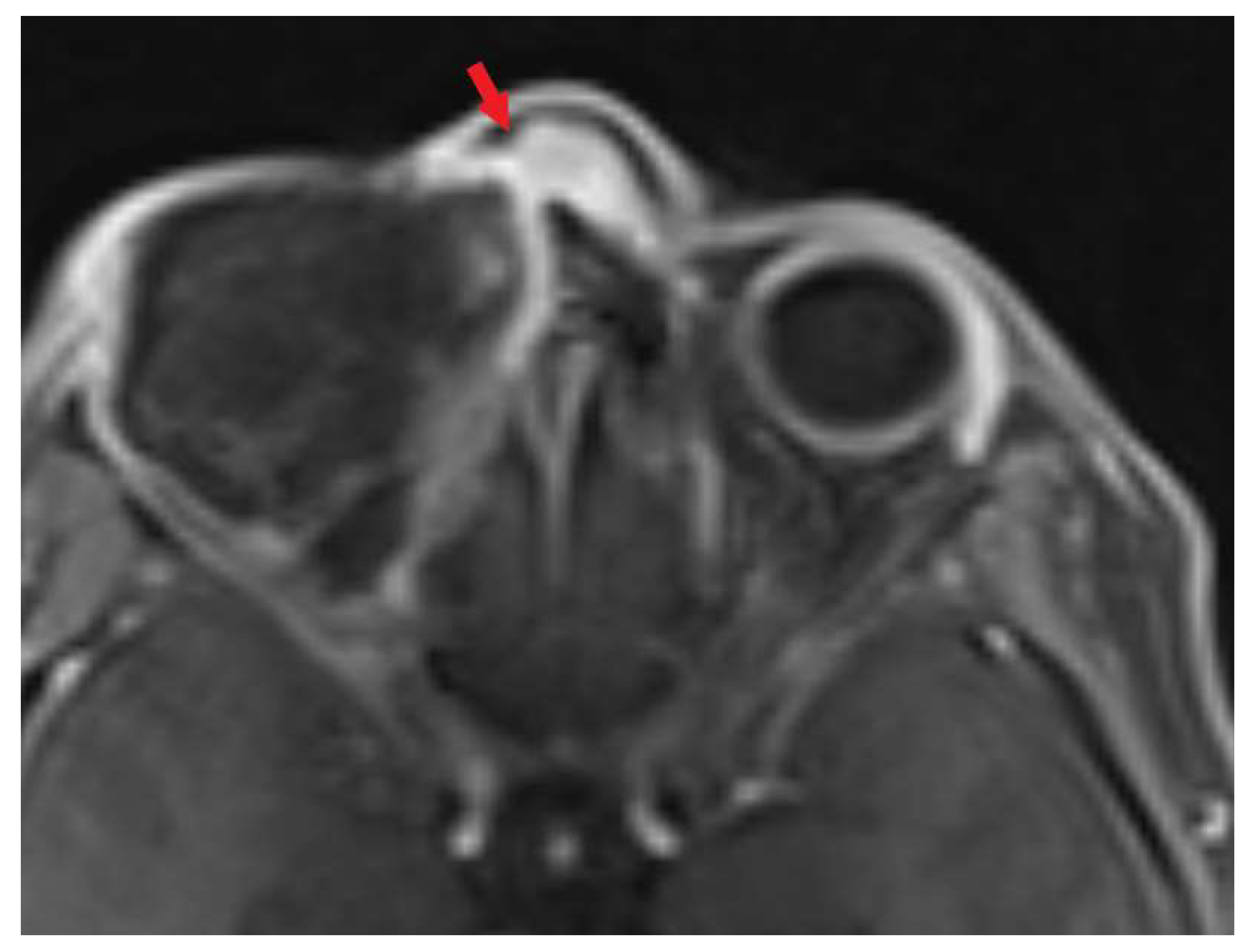 Biomedicines 11 01538 g005 550
