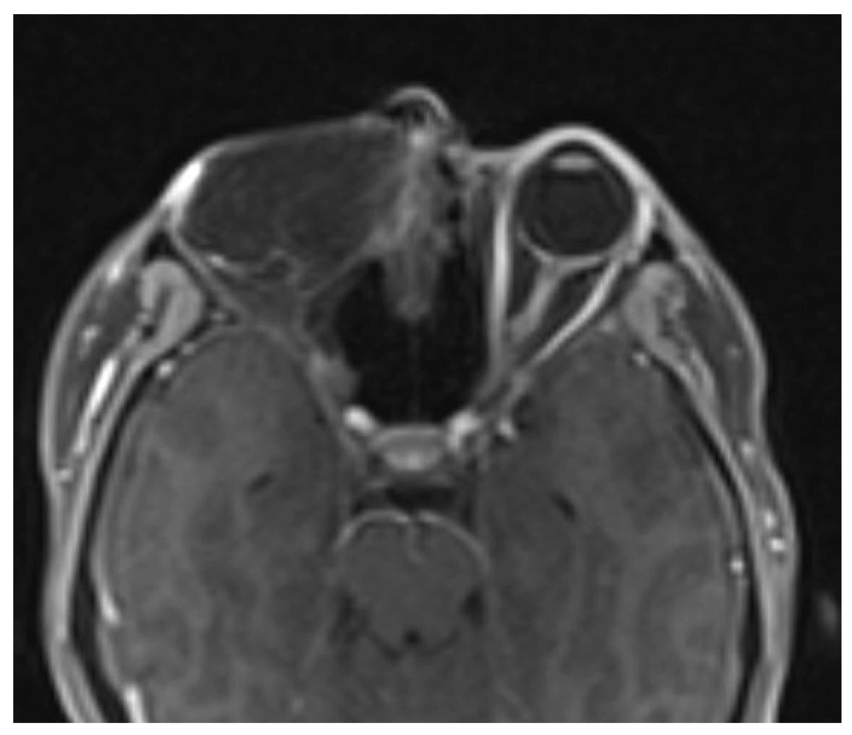 Biomedicines 11 01538 g006 550