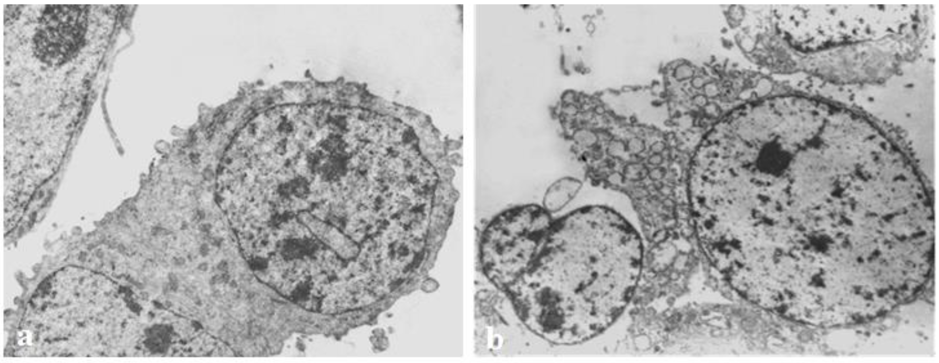 Biomedicines 11 01545 g004 Biomedicines 11 01545 g004