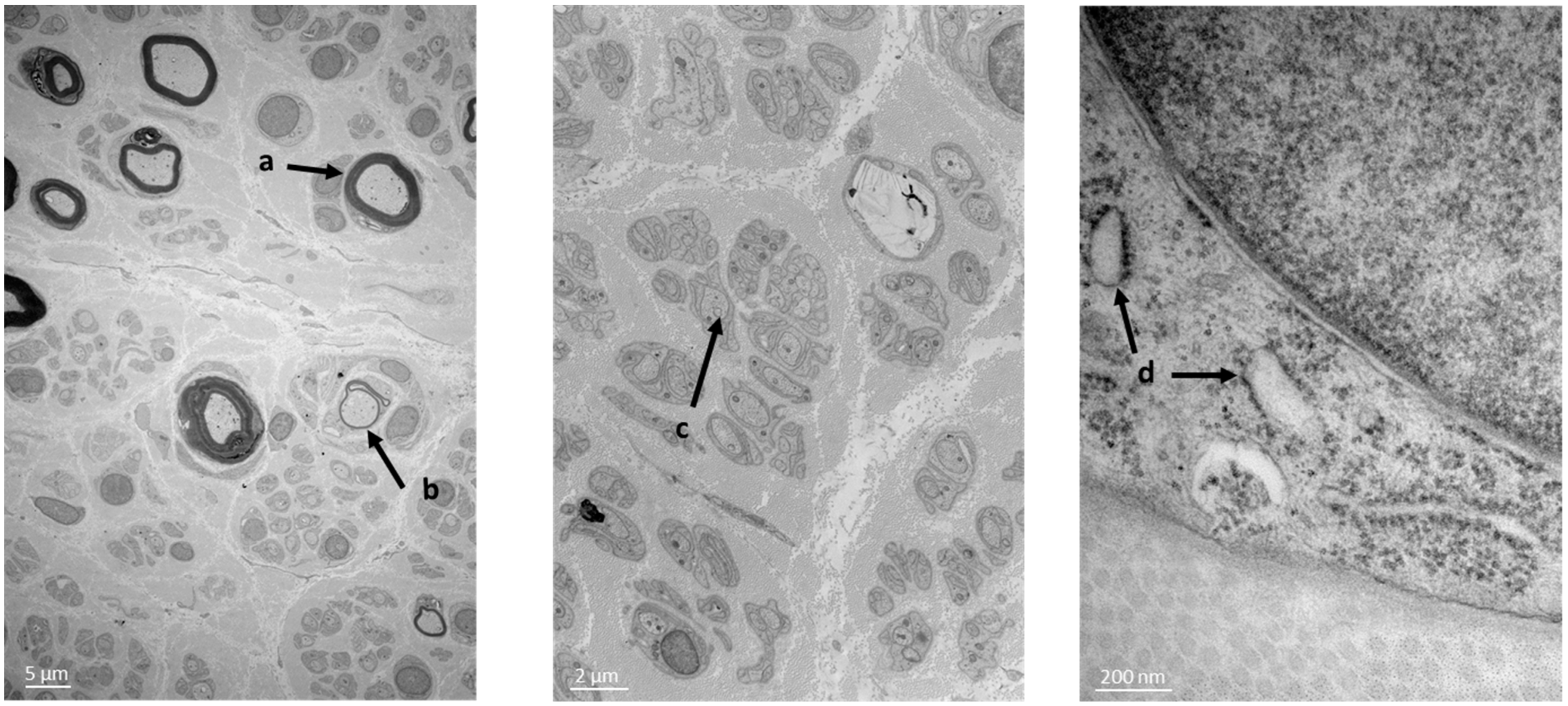 Biomedicines 11 01565 g001