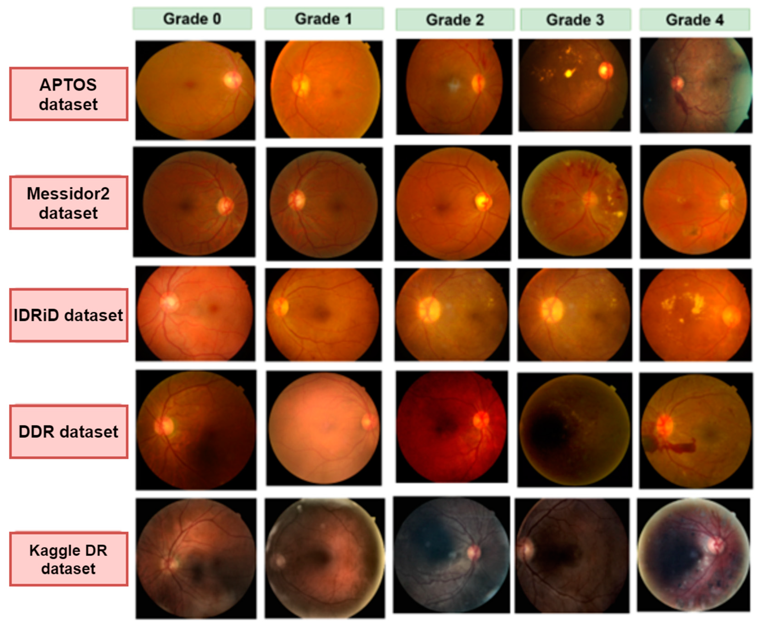 Biomedicines 11 01566 g002 Biomedicines 11 01566 g002