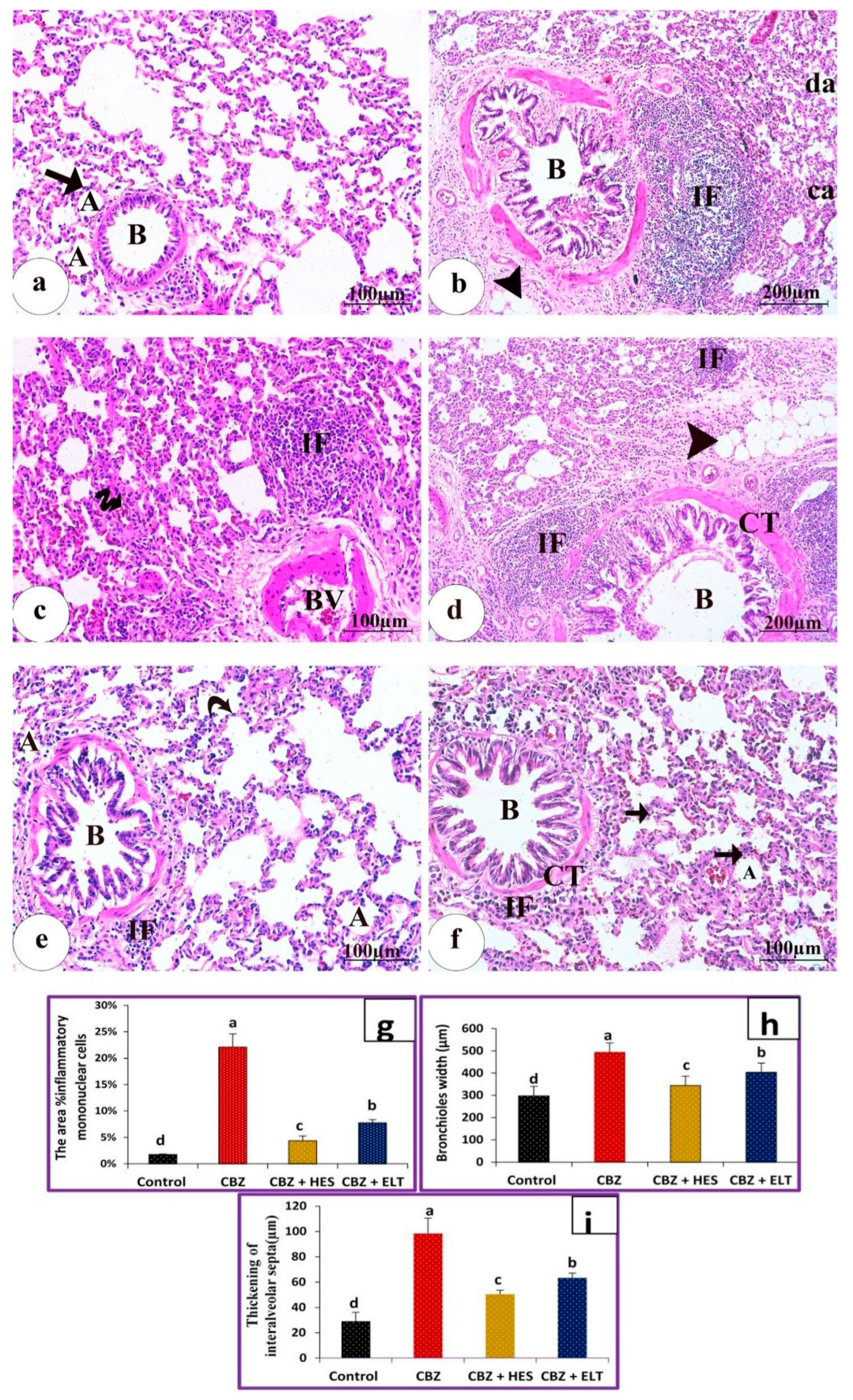 Biomedicines 11 01570 g002 Biomedicines 11 01570 g002