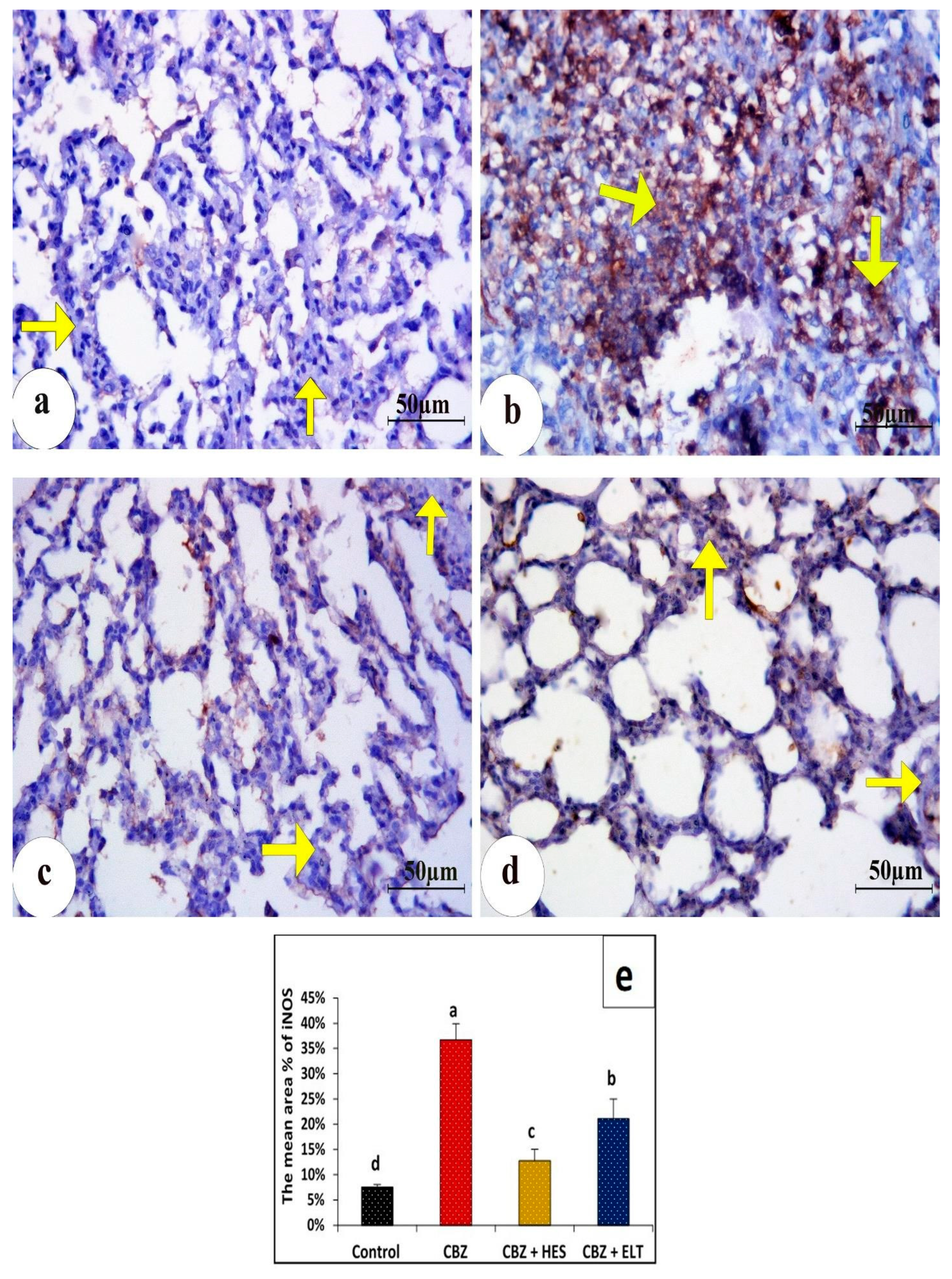 Biomedicines 11 01570 g003 Biomedicines 11 01570 g003