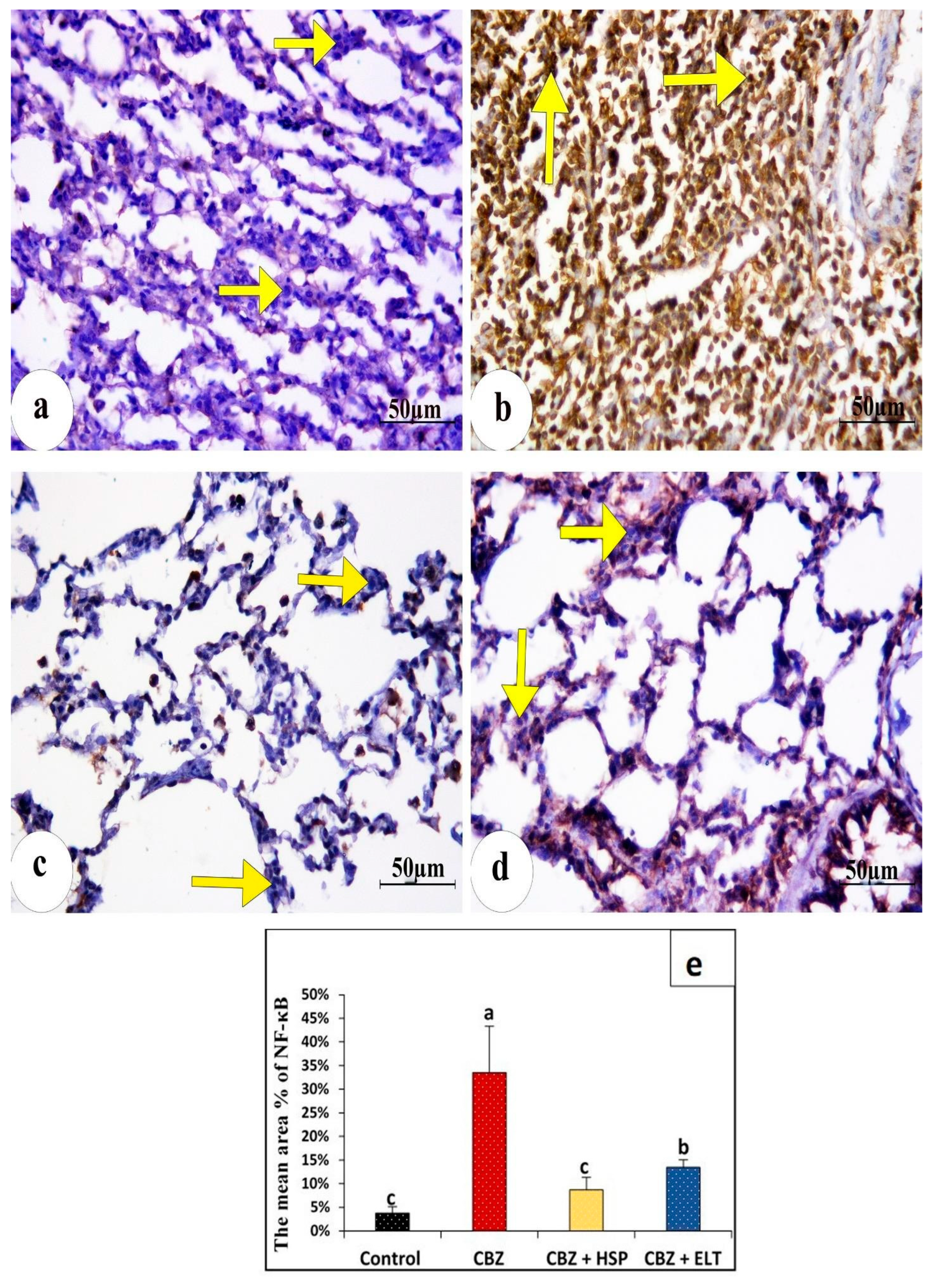Biomedicines 11 01570 g004 Biomedicines 11 01570 g004
