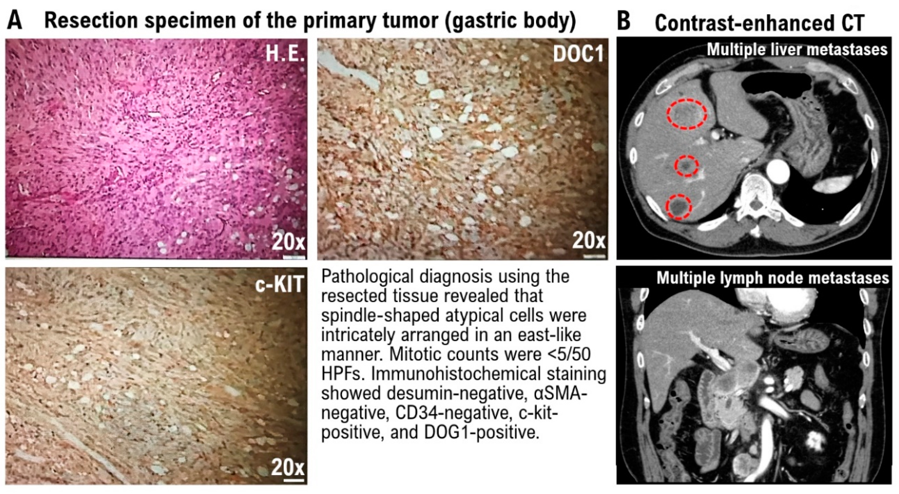 Biomedicines 11 01590 g001