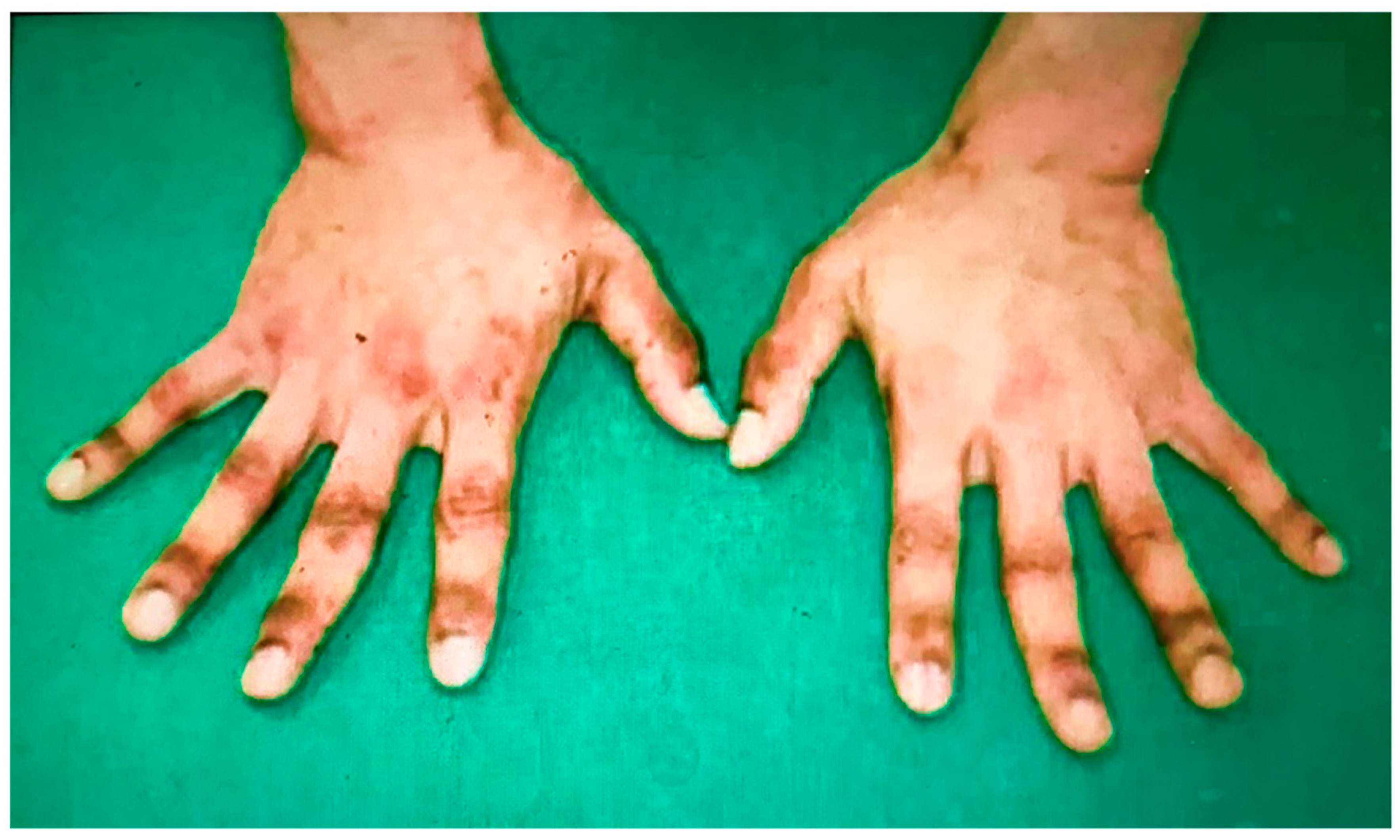 Biomedicines 11 01590 g002