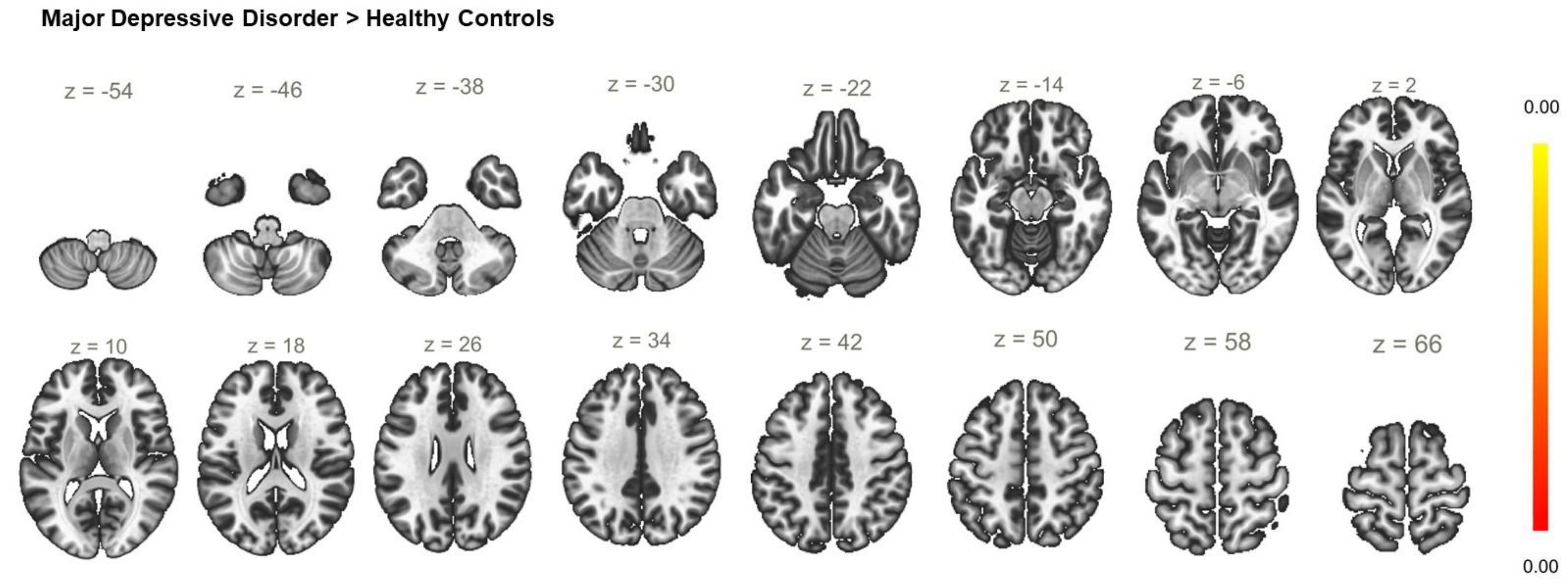 Biomedicines 11 01608 g008