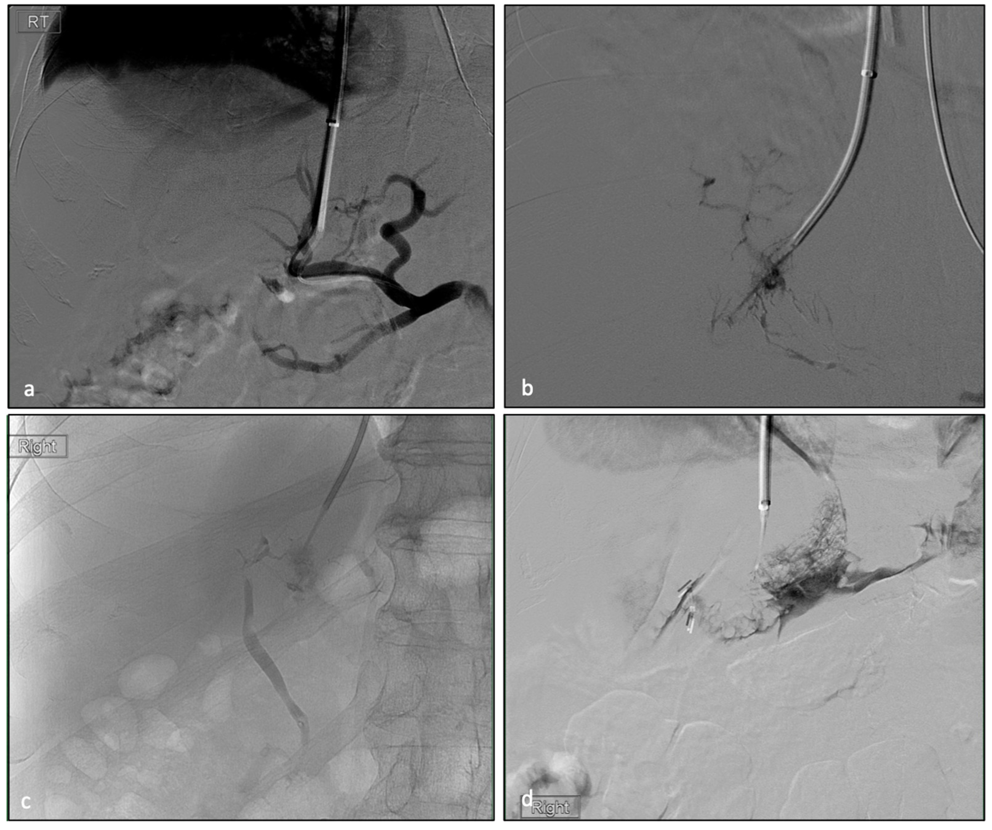 Biomedicines 11 01630 g001