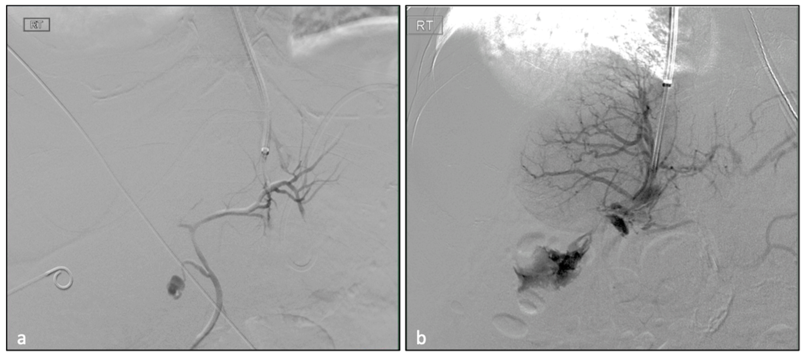 Biomedicines 11 01630 g002