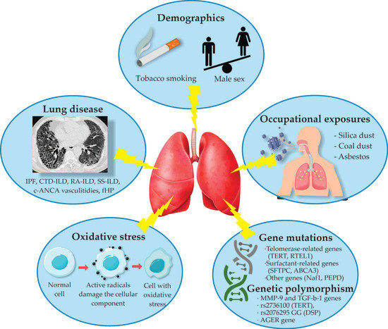 Combined Pulmonary Fibrosis And Emphysema Comparative Evidence On A combined-pulmonary-fibrosis-and-emphysema-comparative-evidence-on-a