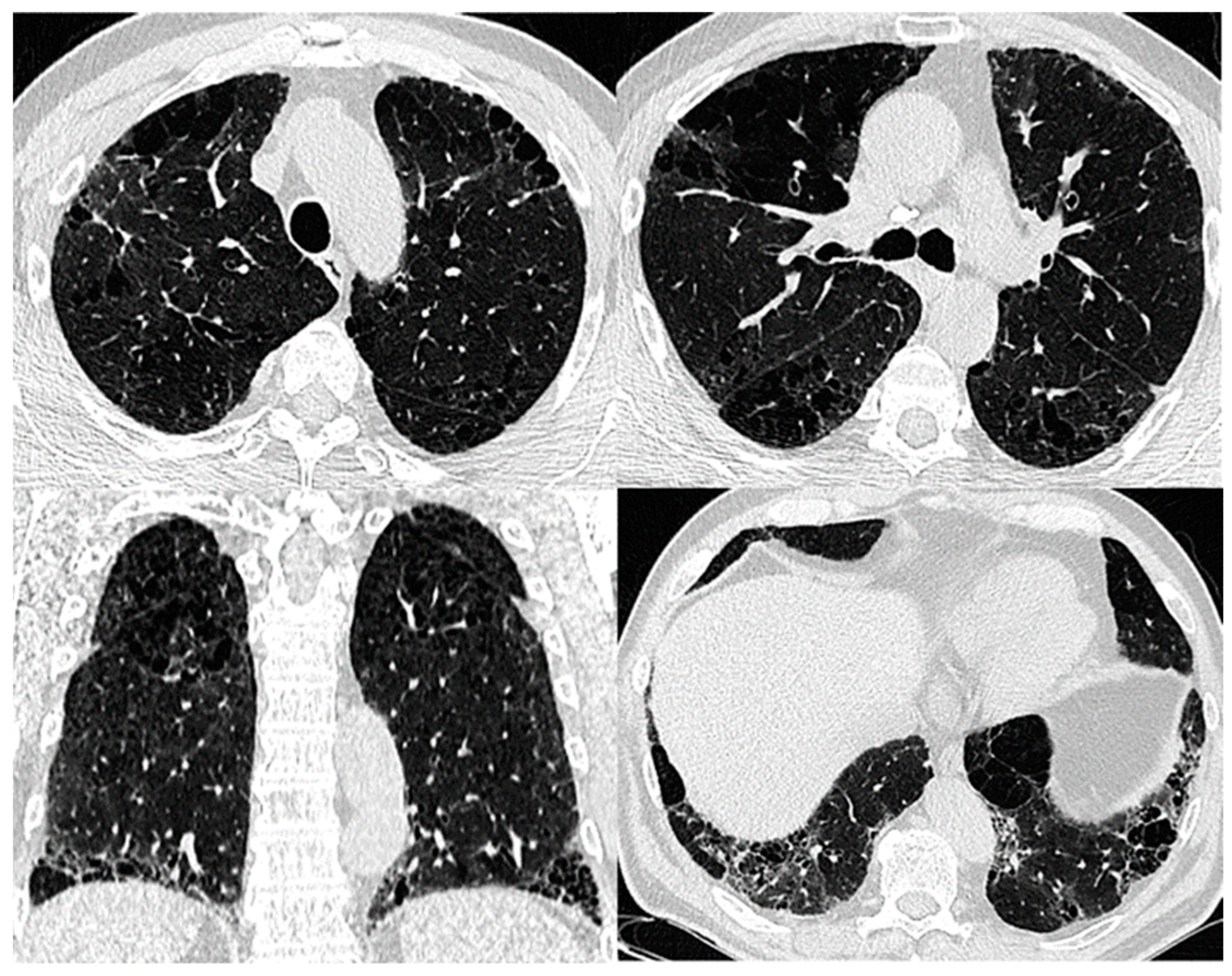 Biomedicines 11 01636 g003 Biomedicines 11 01636 g003