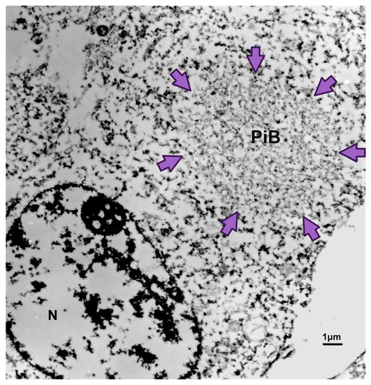 Biomedicines Free FullText Pick’s Disease, Seeding an Answer to the Clinical Diagnosis