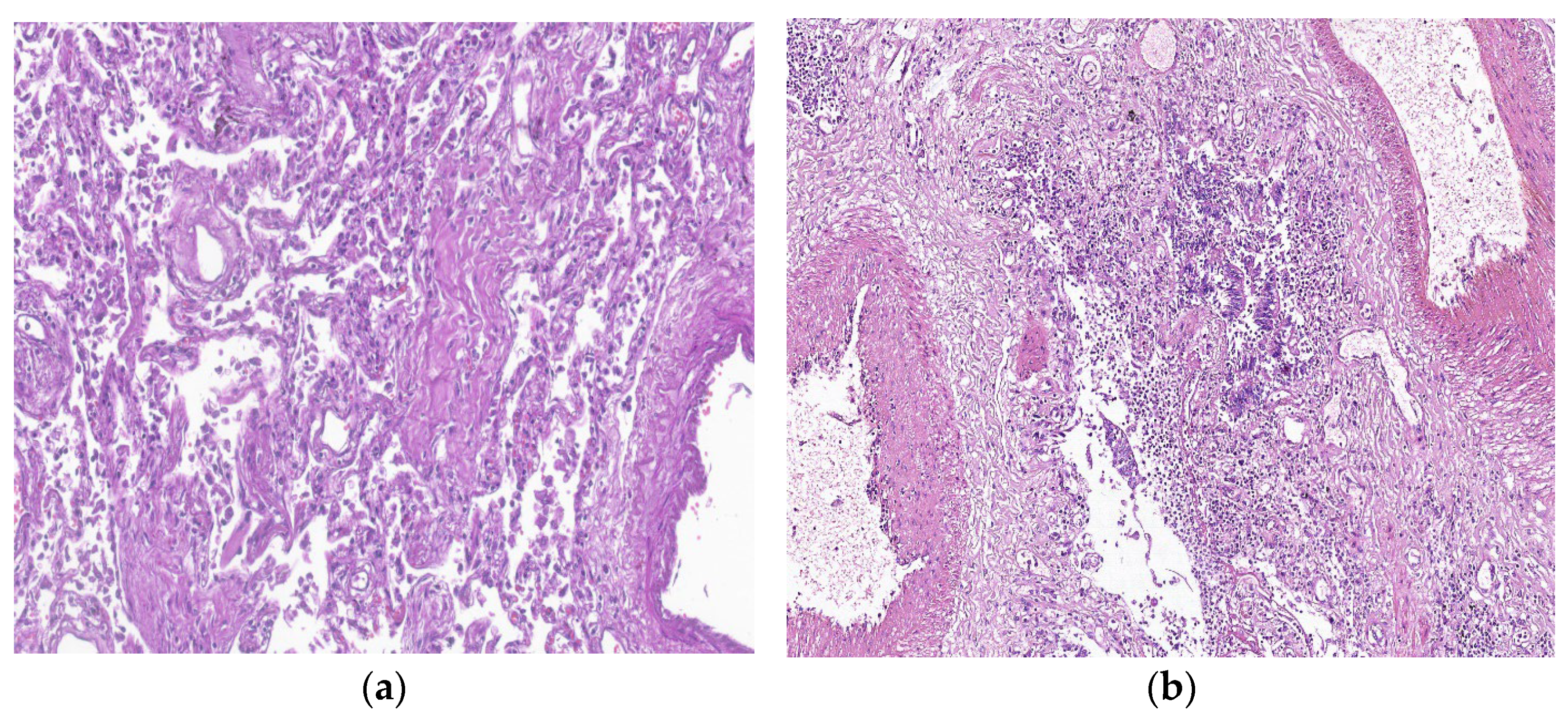 Biomedicines 11 01739 g004 Biomedicines 11 01739 g004