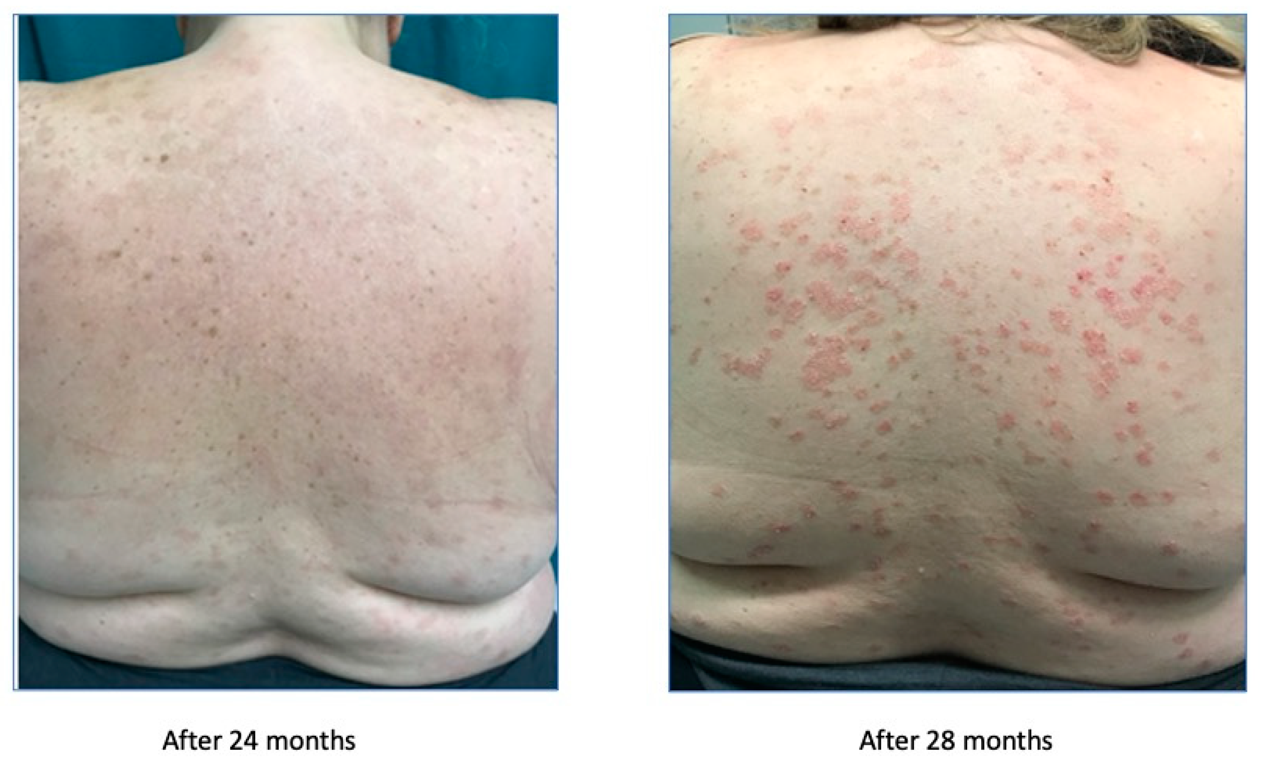 Biomedicines 11 01769 g005 Biomedicines 11 01769 g005