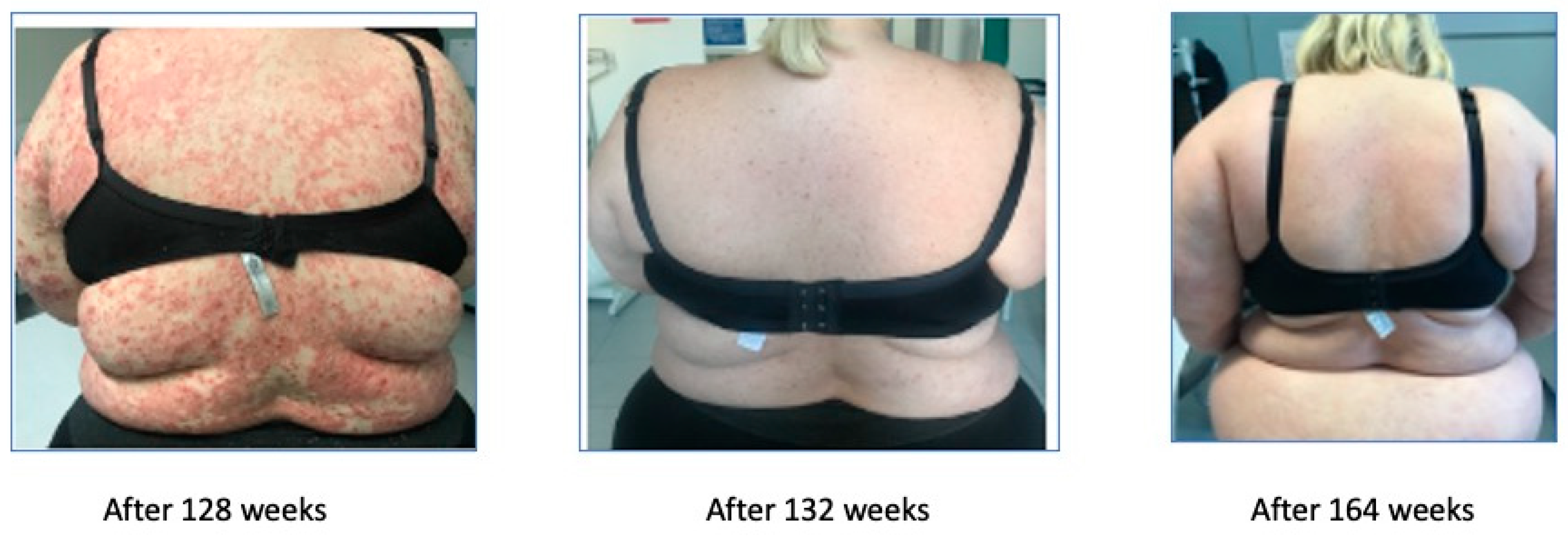 Biomedicines 11 01769 g007 Biomedicines 11 01769 g007