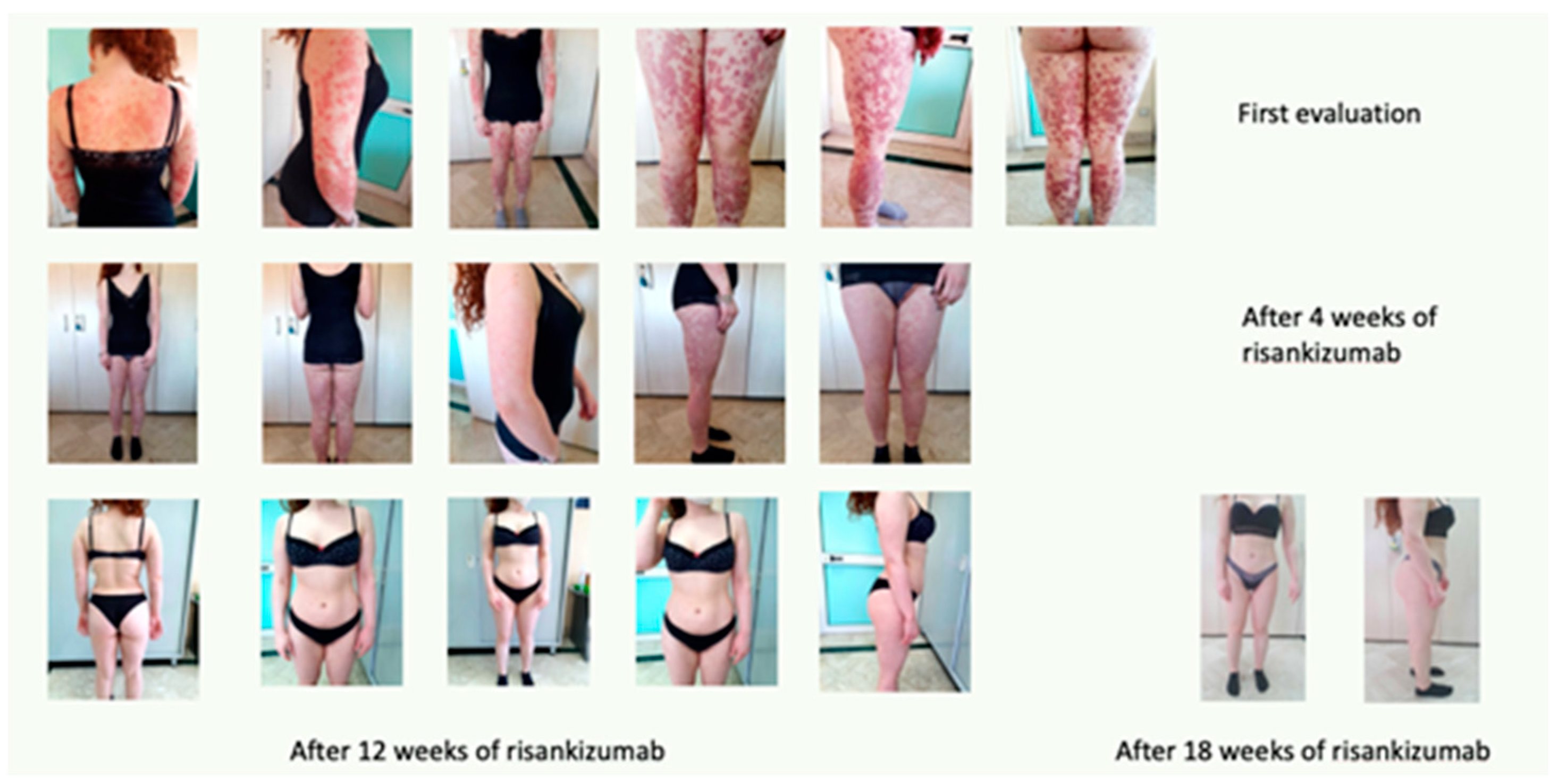 Biomedicines 11 01769 g011 Biomedicines 11 01769 g011