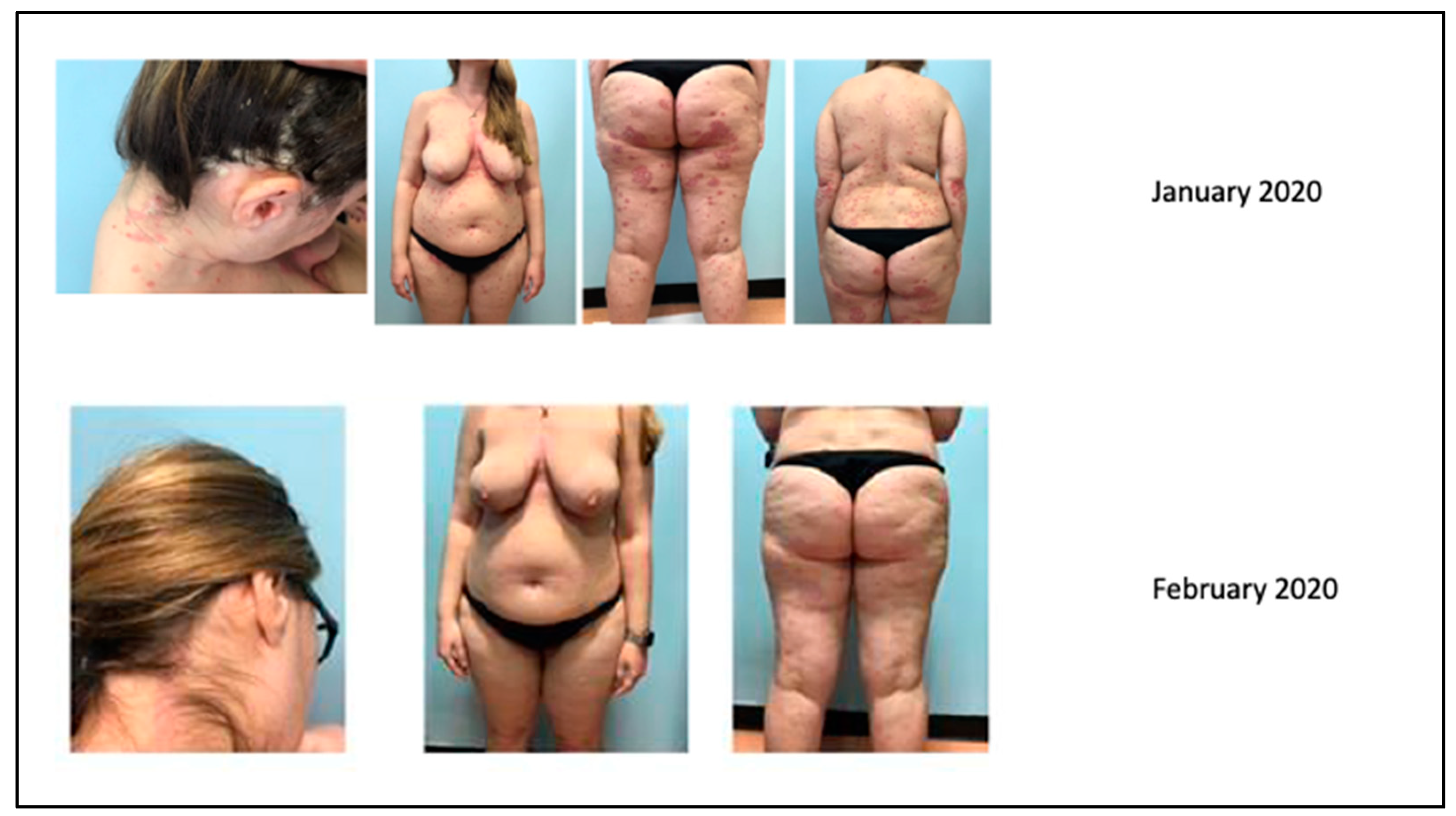 Biomedicines 11 01769 g012 Biomedicines 11 01769 g012