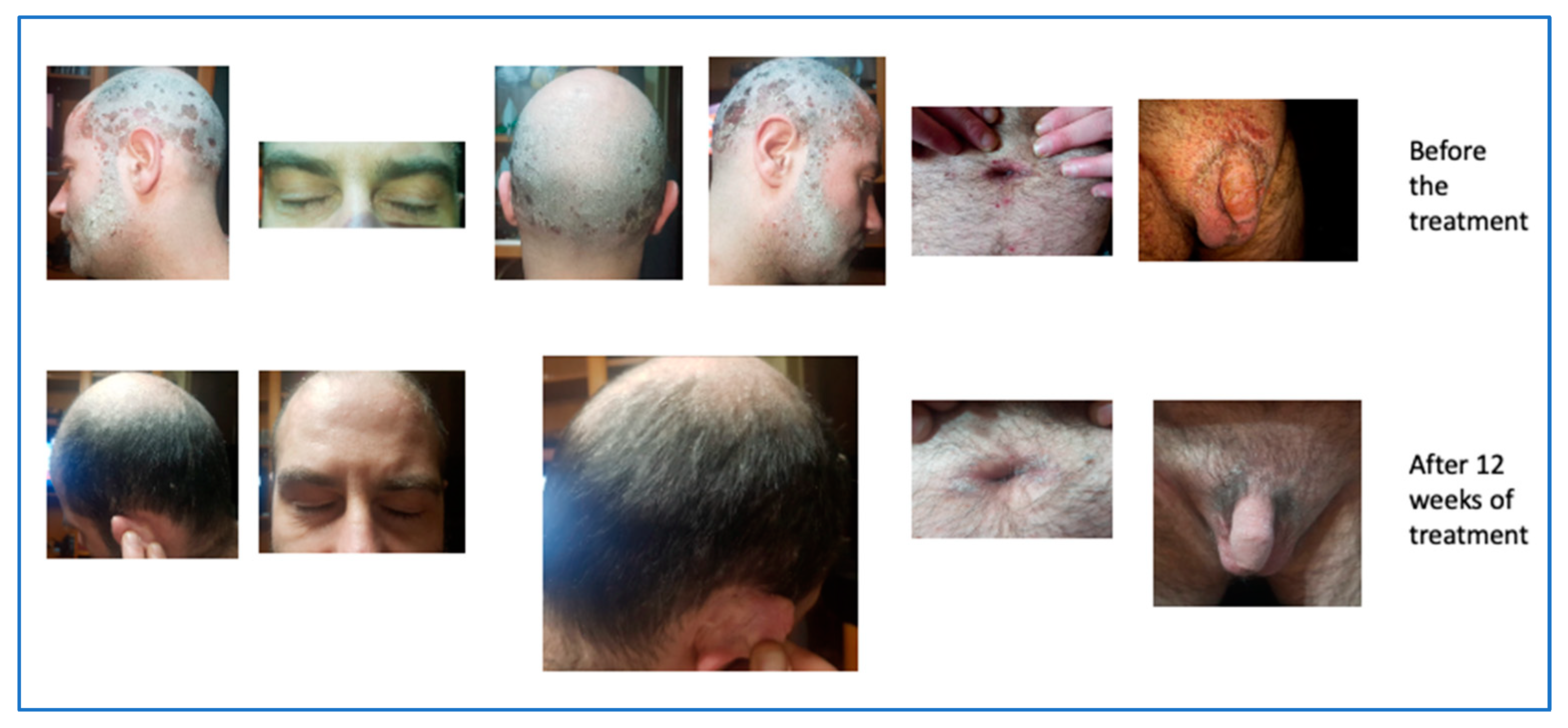 Biomedicines 11 01769 g013 Biomedicines 11 01769 g013