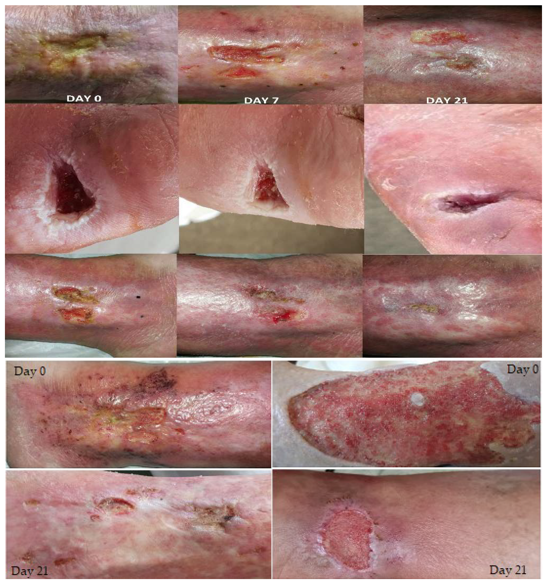 Biomedicines 11 01815 g004