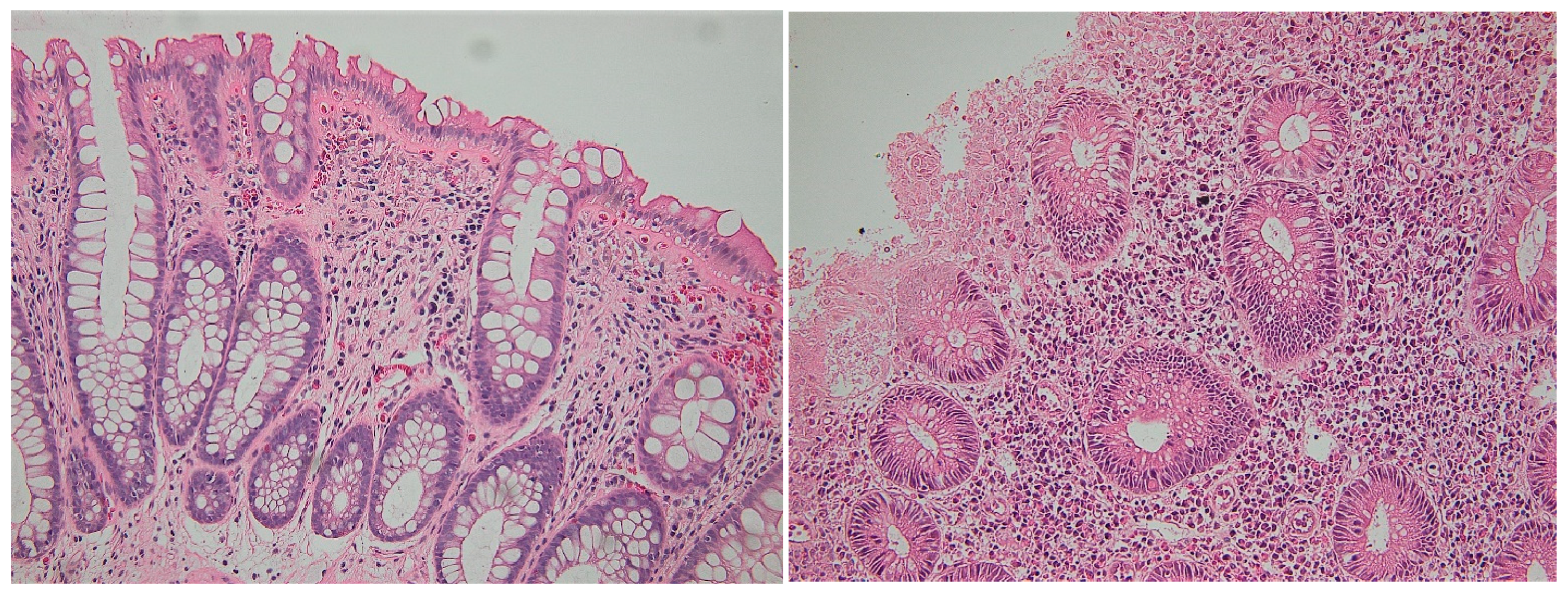 Biomedicines 11 01860 g003 Biomedicines 11 01860 g003