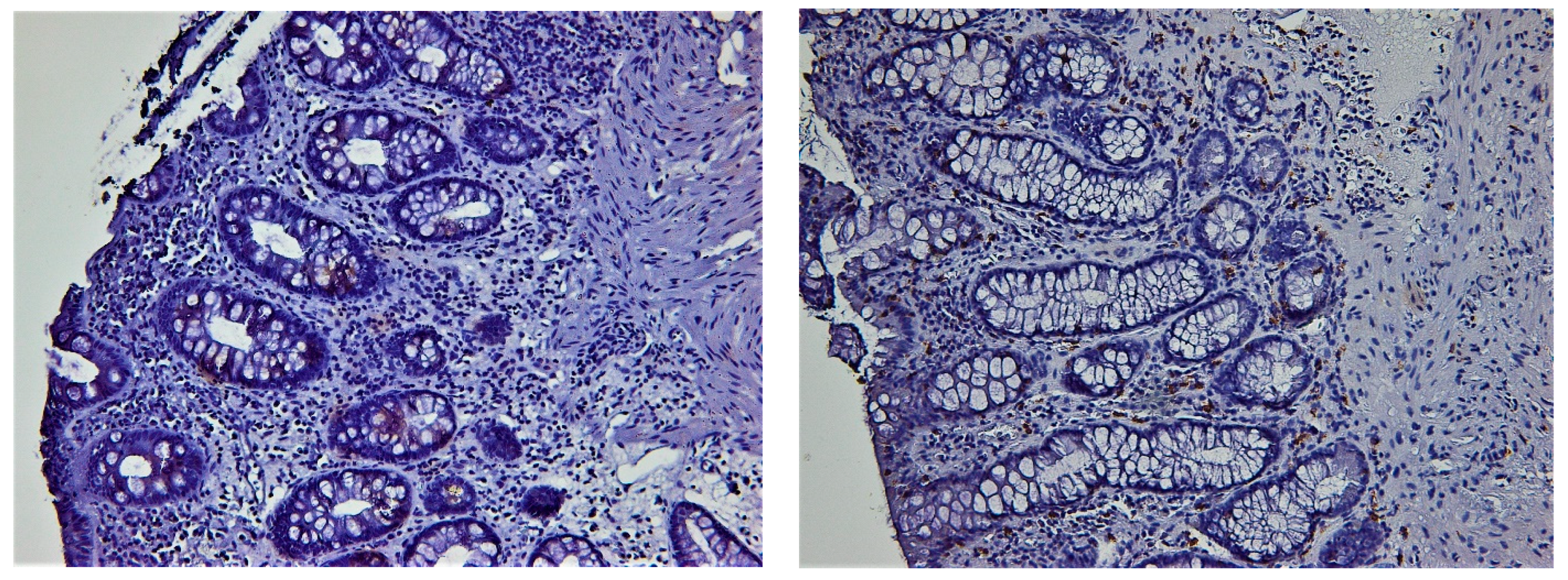 Biomedicines 11 01860 g004 Biomedicines 11 01860 g004