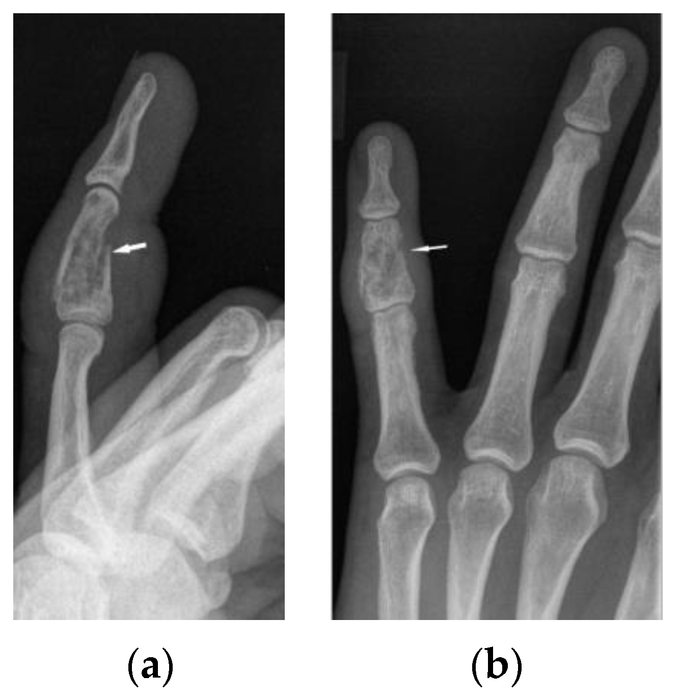 Biomedicines 11 01866 g006