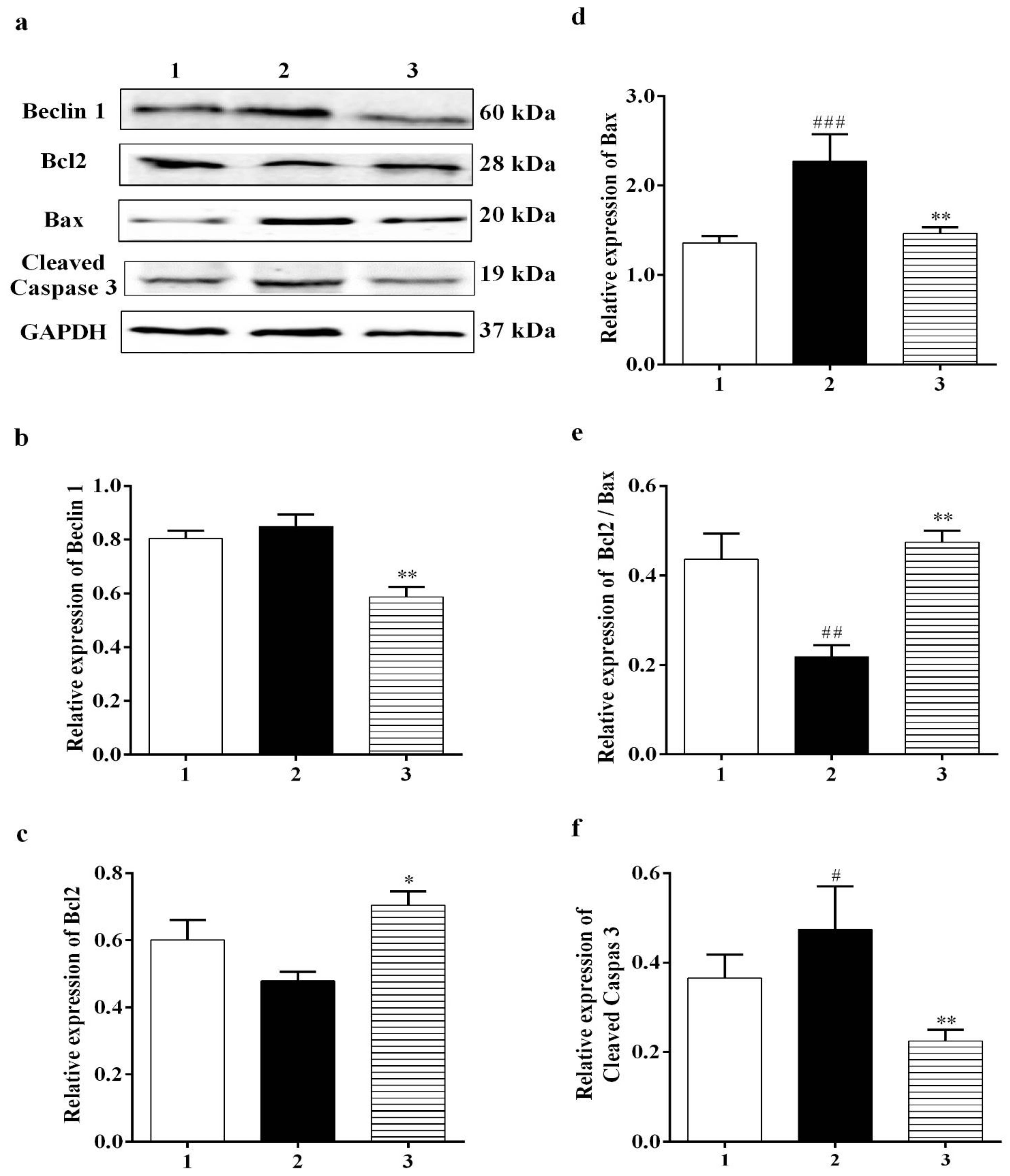 Biomedicines 11 01885 g007 Biomedicines 11 01885 g007