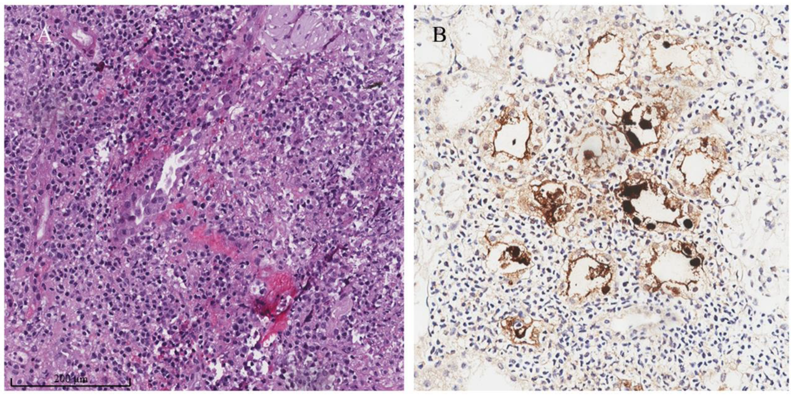 Biomedicines 11 01902 g004