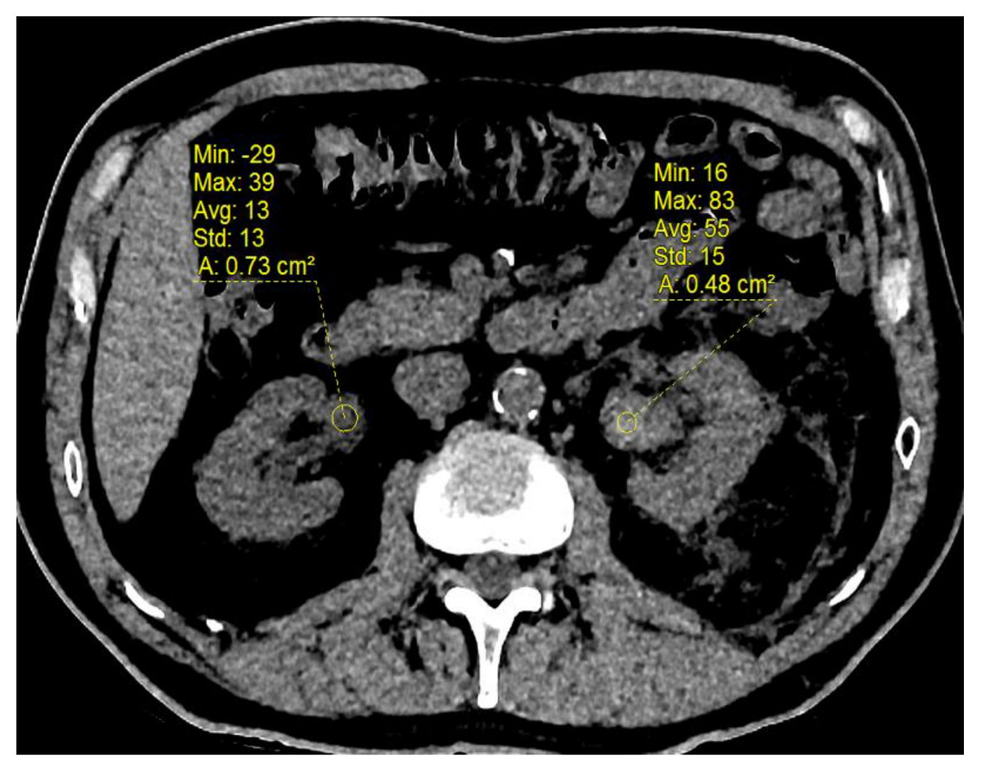 Biomedicines 11 01935 g003 Biomedicines 11 01935 g003