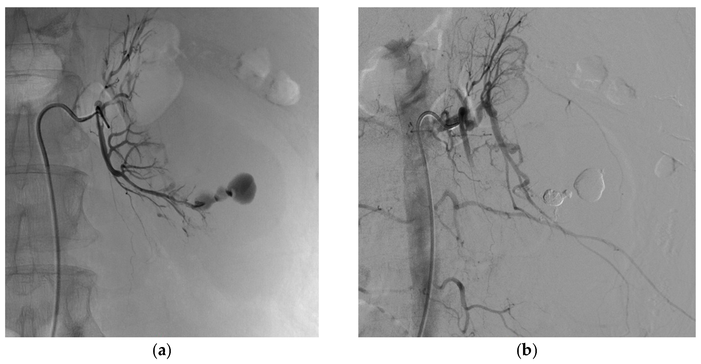 Biomedicines 11 01935 g005 Biomedicines 11 01935 g005