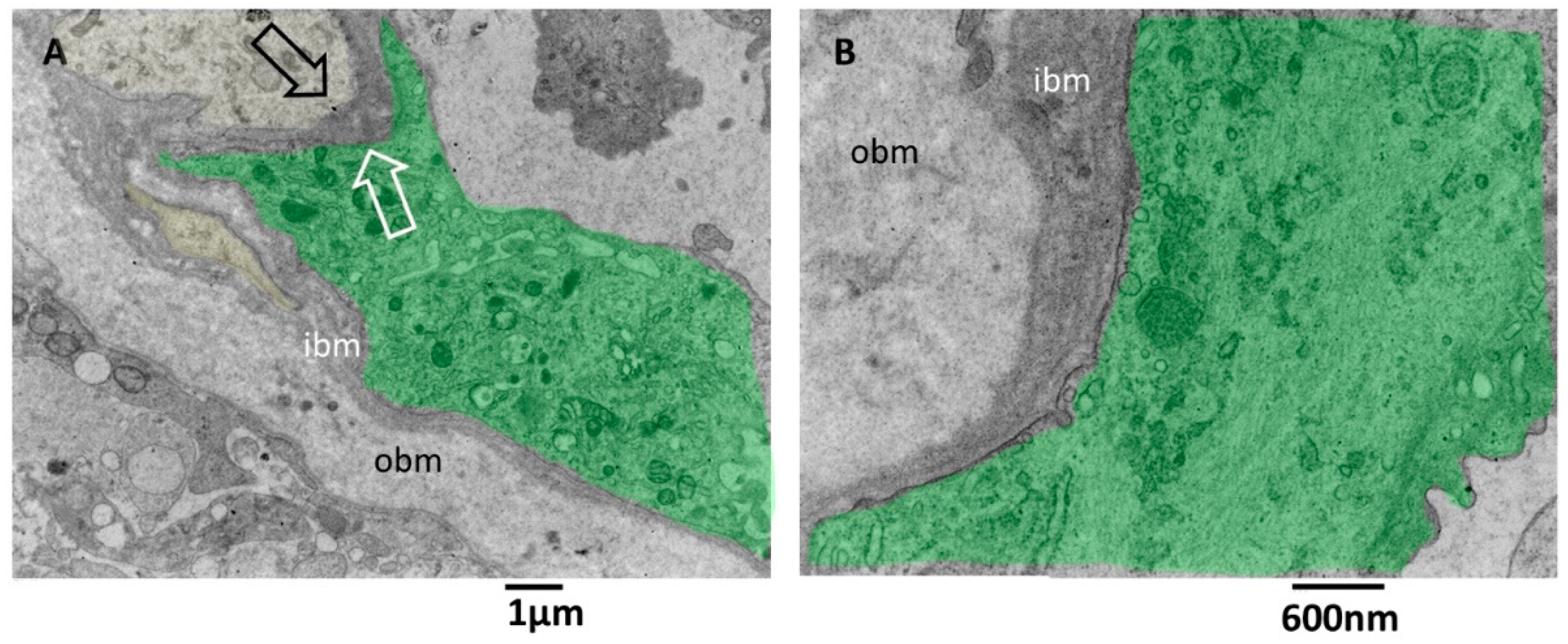 Biomedicines 11 01968 g006 Biomedicines 11 01968 g006