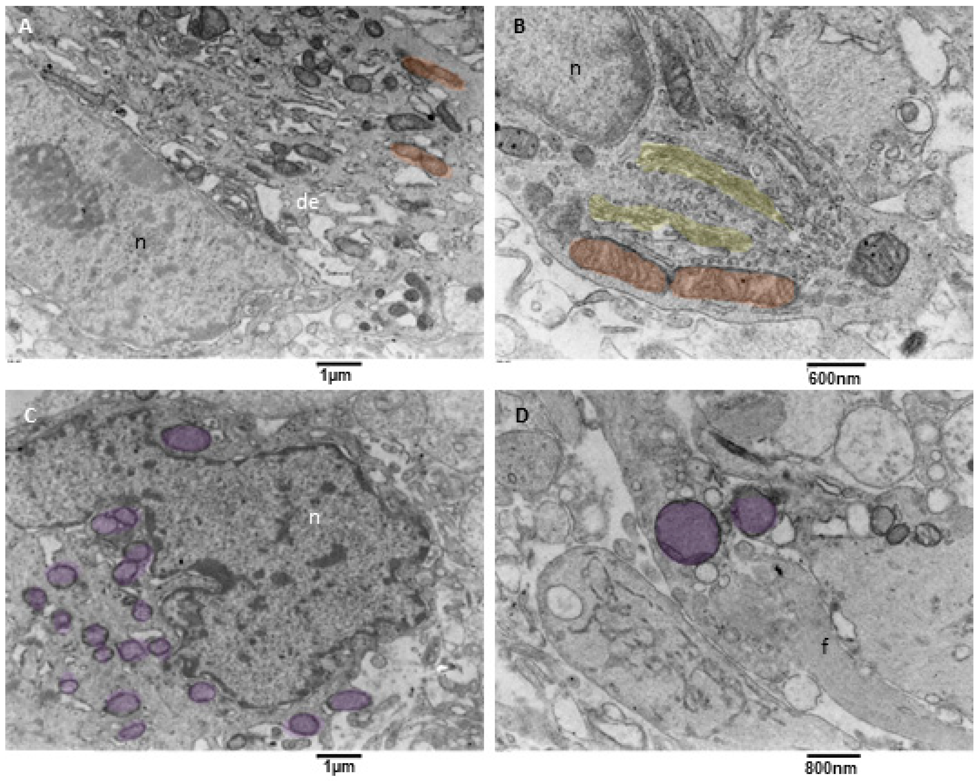 Biomedicines 11 01968 g008 Biomedicines 11 01968 g008