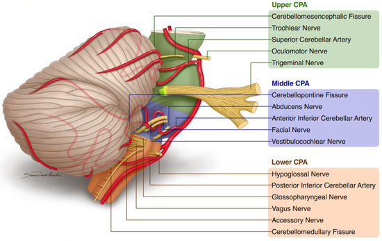 Cerebellar Artery - an overview