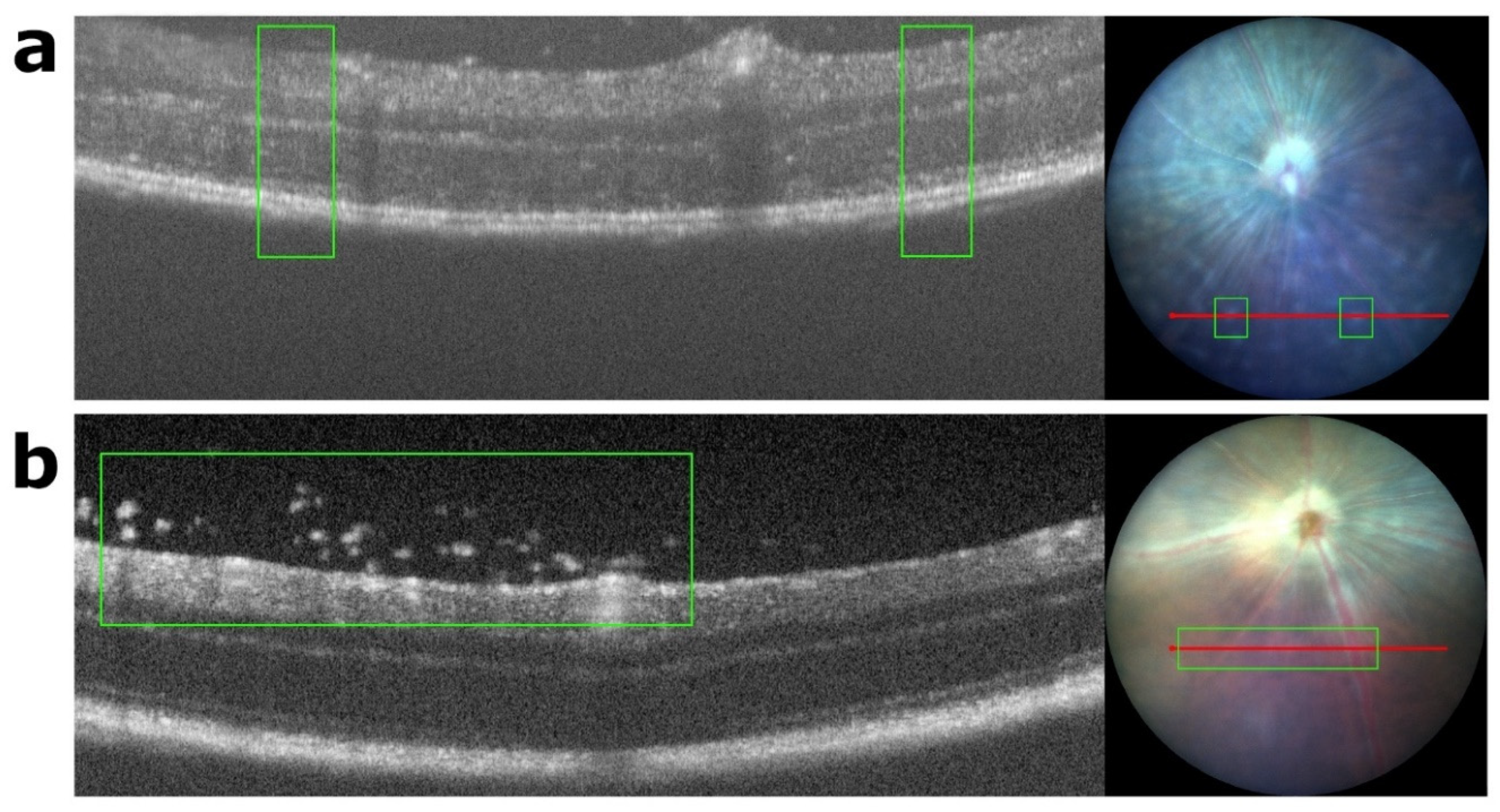 Biomedicines 11 02022 g0a4 Biomedicines 11 02022 g0a4