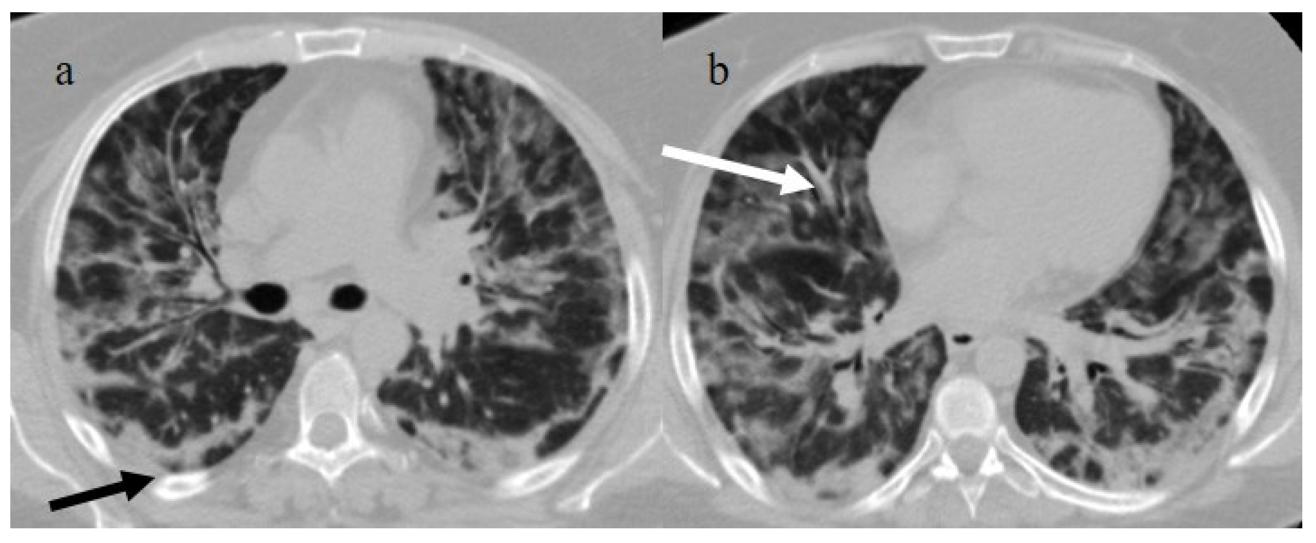 Biomedicines 11 02113 g001 Biomedicines 11 02113 g001