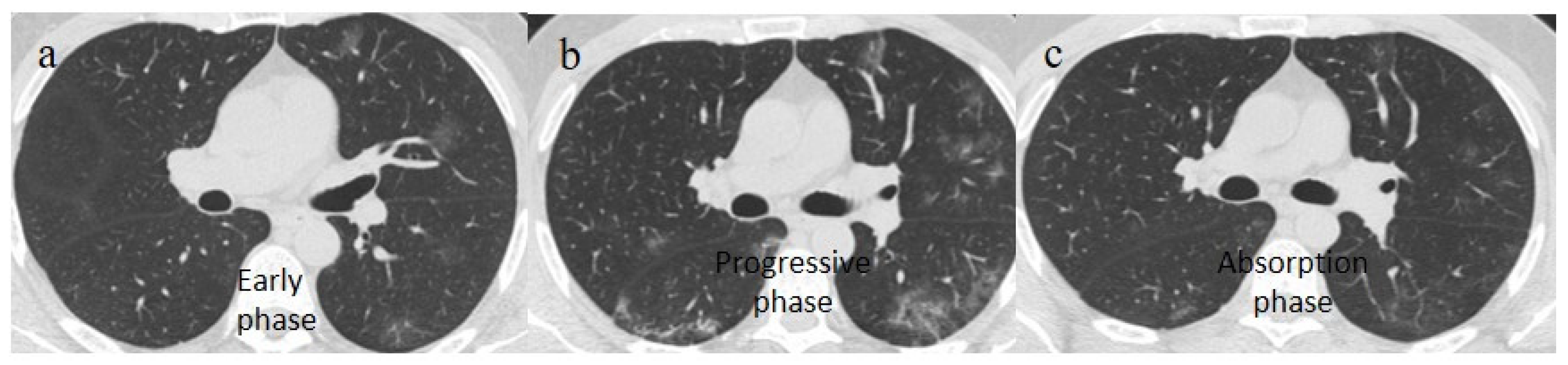 Biomedicines 11 02113 g002 Biomedicines 11 02113 g002