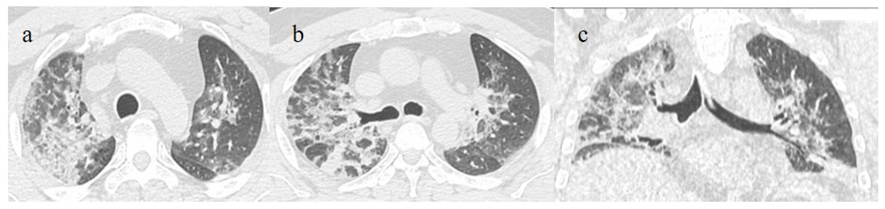 Biomedicines 11 02113 g006 Biomedicines 11 02113 g006