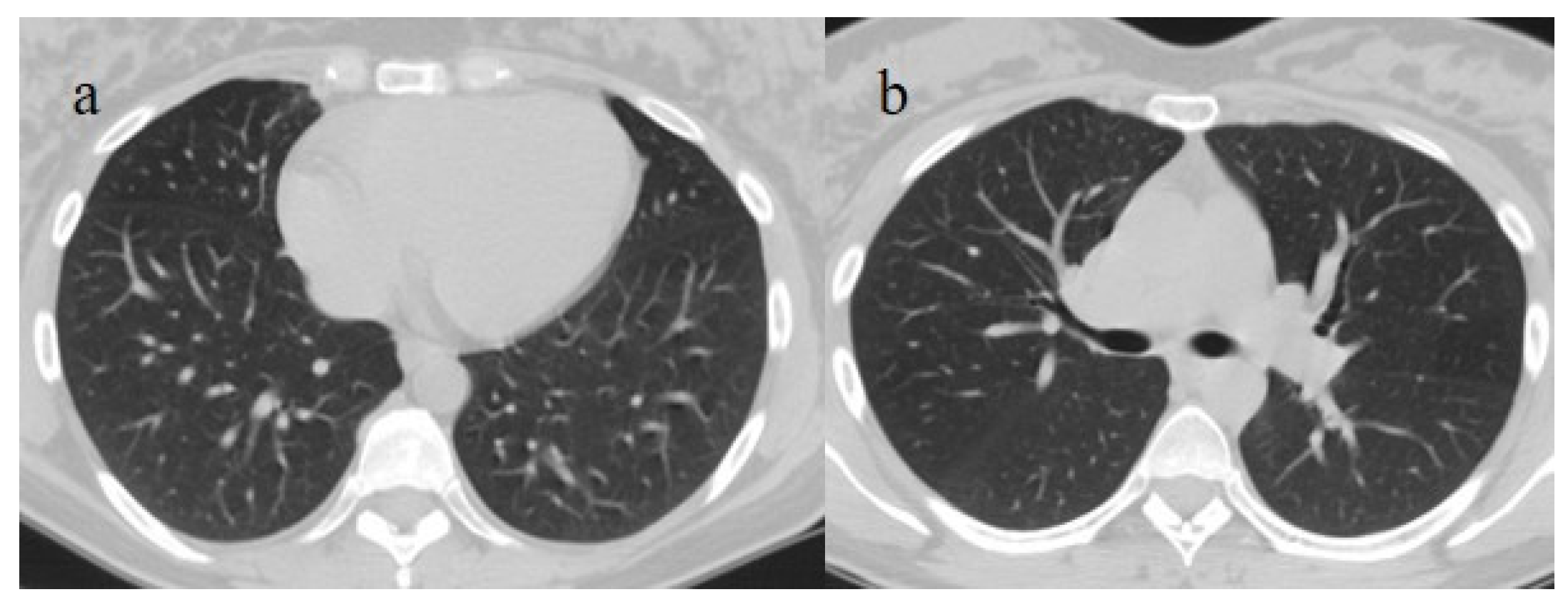 Biomedicines 11 02113 g008 Biomedicines 11 02113 g008