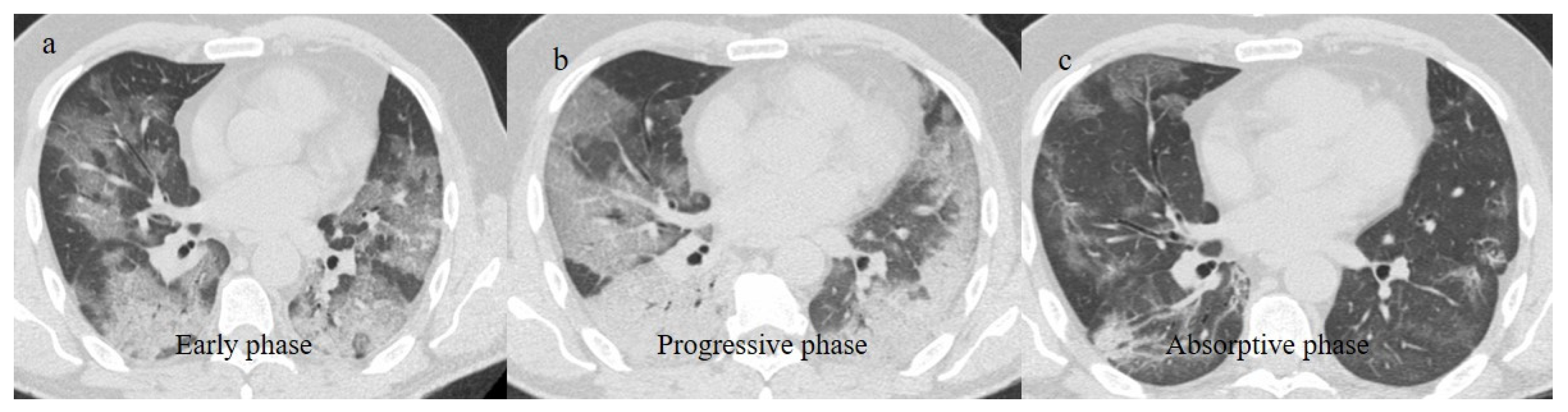 Biomedicines 11 02113 g013 Biomedicines 11 02113 g013