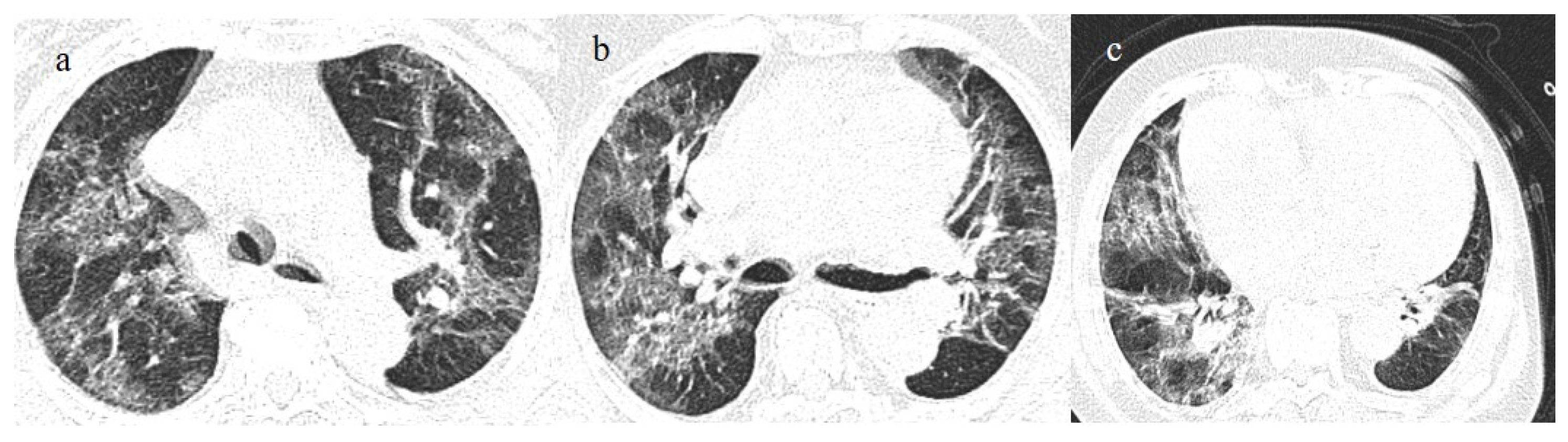 Biomedicines 11 02113 g014 Biomedicines 11 02113 g014