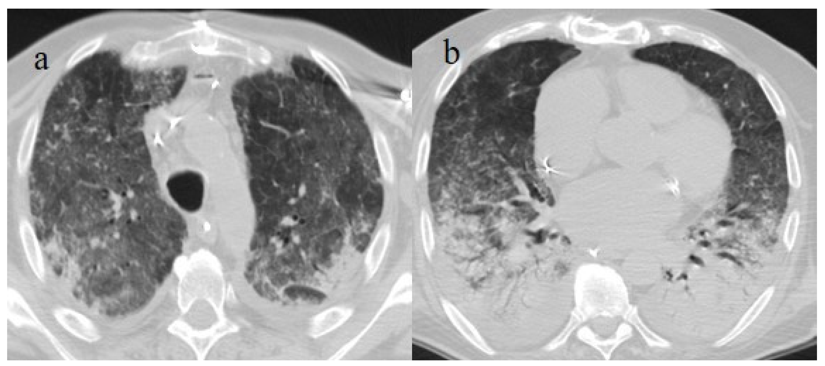 Biomedicines 11 02113 g016 Biomedicines 11 02113 g016