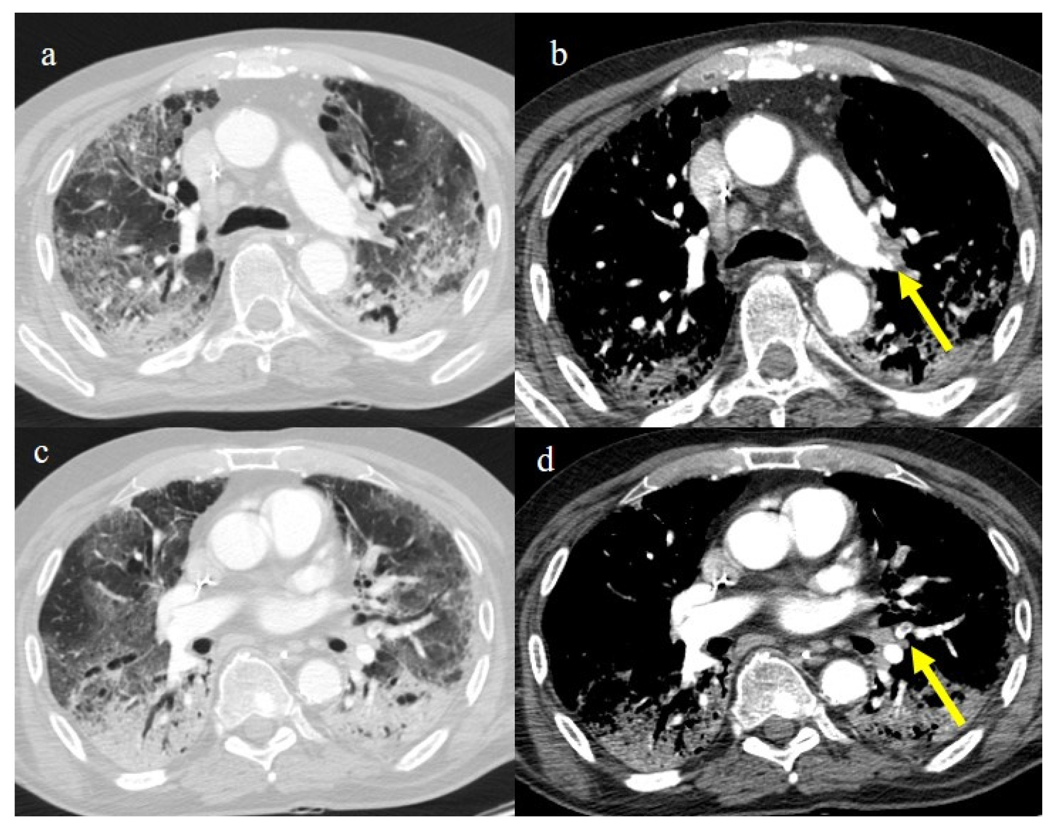 Biomedicines 11 02113 g022 Biomedicines 11 02113 g022