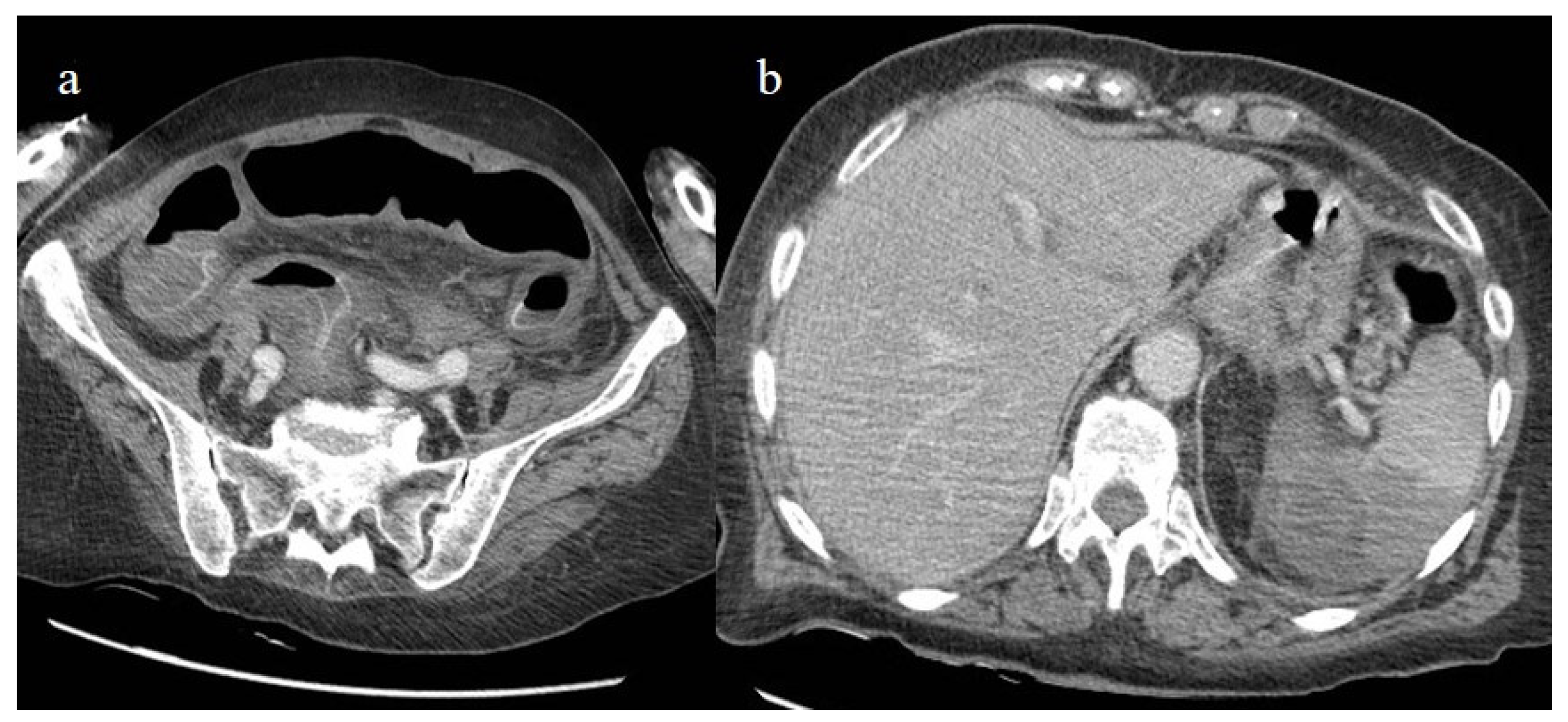 Biomedicines 11 02113 g024 Biomedicines 11 02113 g024
