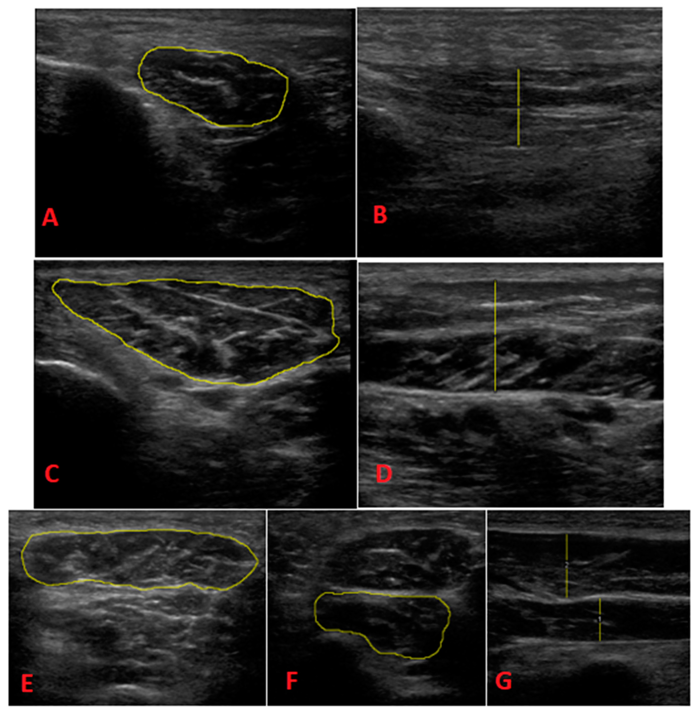 Biomedicines 11 02115 g001