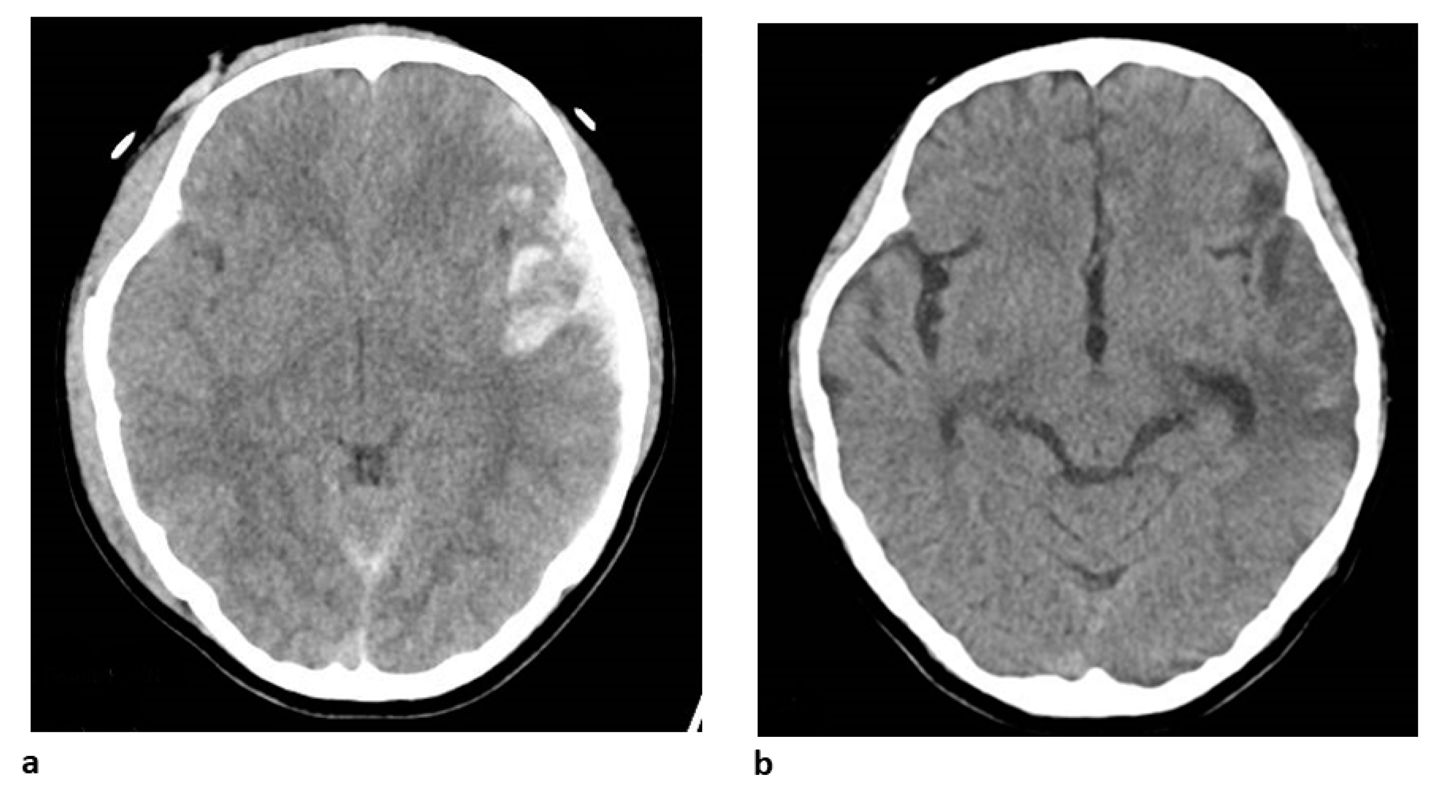 Biomedicines 11 02129 g007 Biomedicines 11 02129 g007