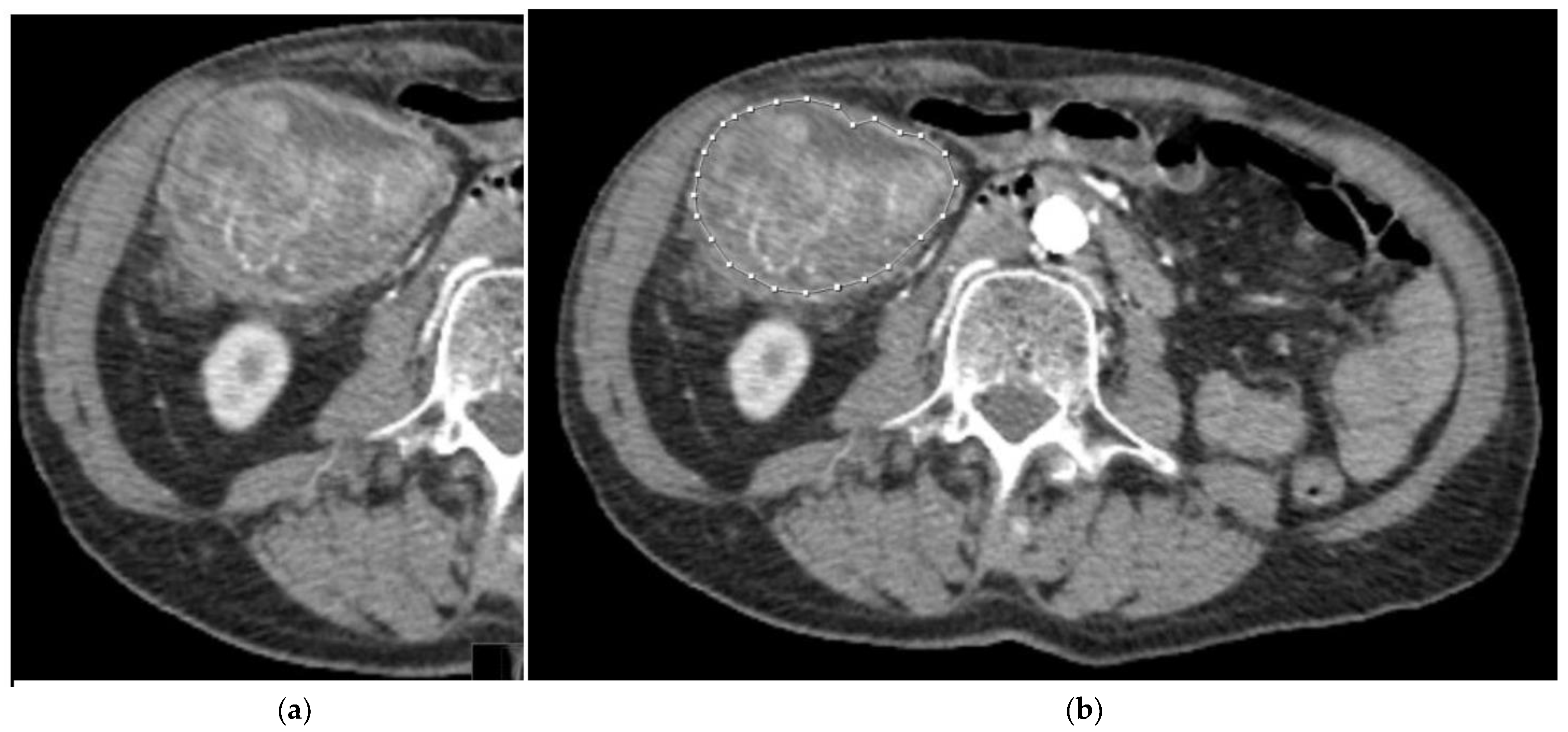 Biomedicines 11 02144 g002