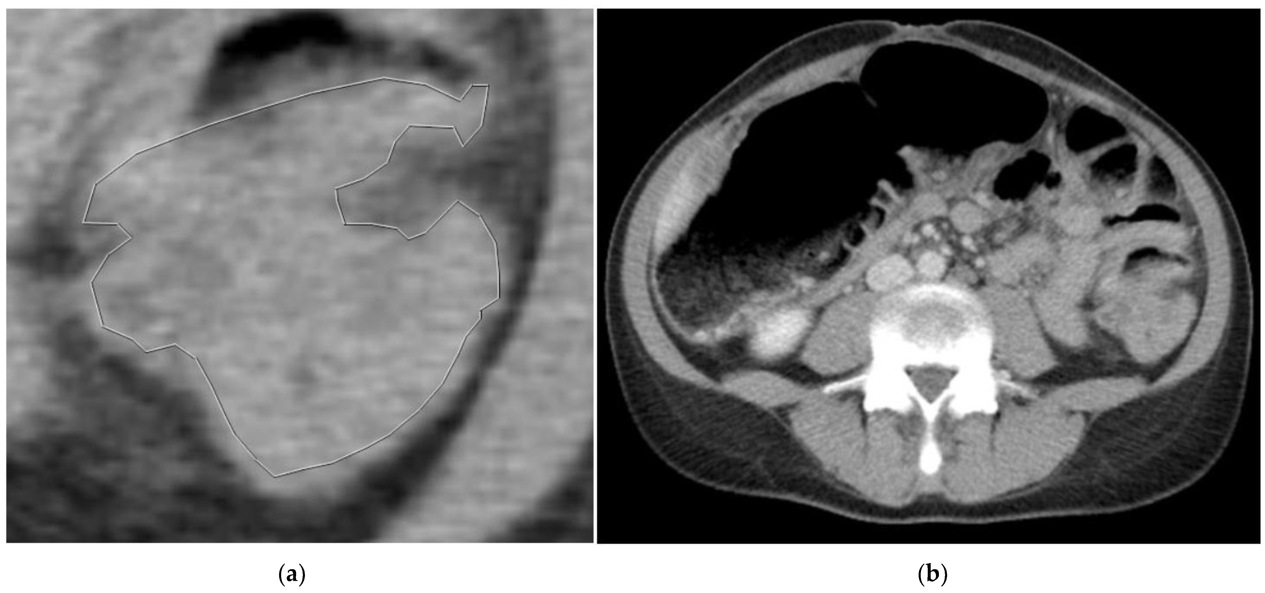 Biomedicines 11 02144 g003