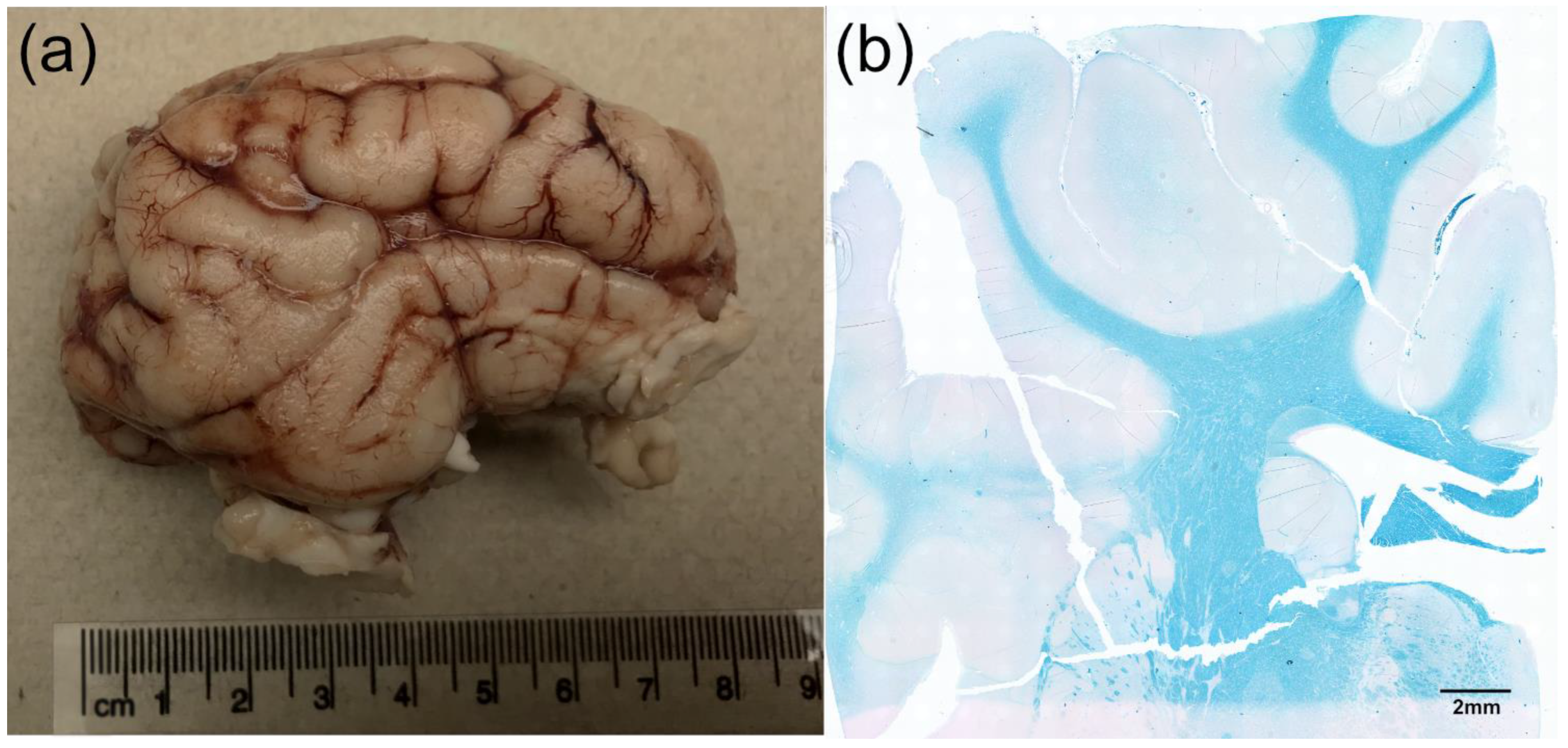 Biomedicines 11 02165 g001 Biomedicines 11 02165 g001